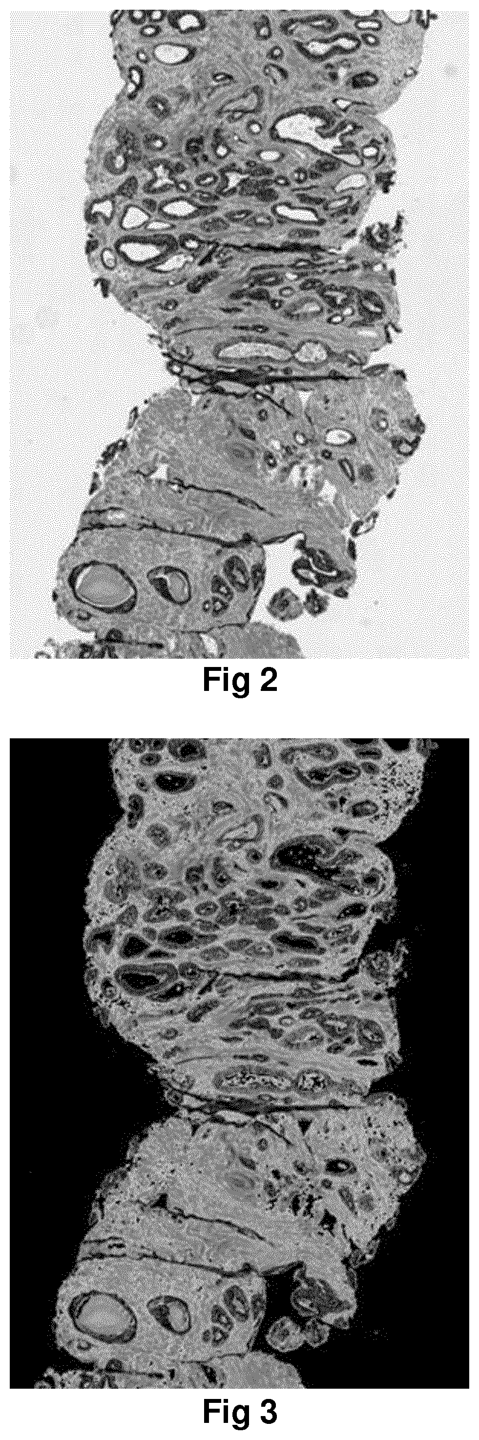 Method for identification of different categories of biopsy sample images