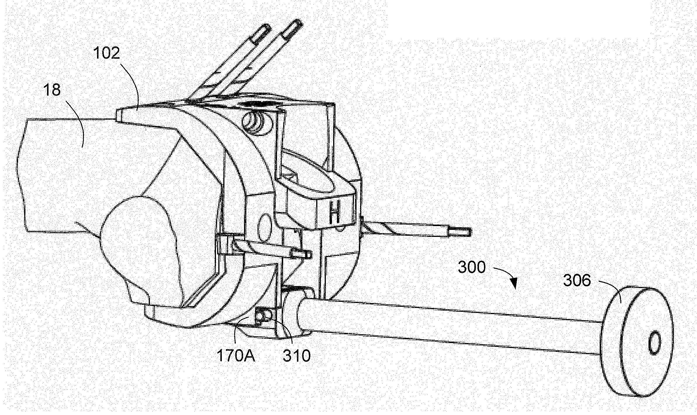 Methods And Apparatus For Preparing An Intercondylar Area Of A Distal Femur