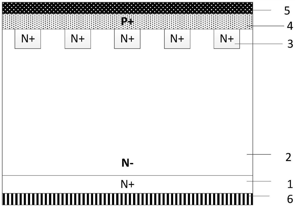 FRD device structure manufacturing method