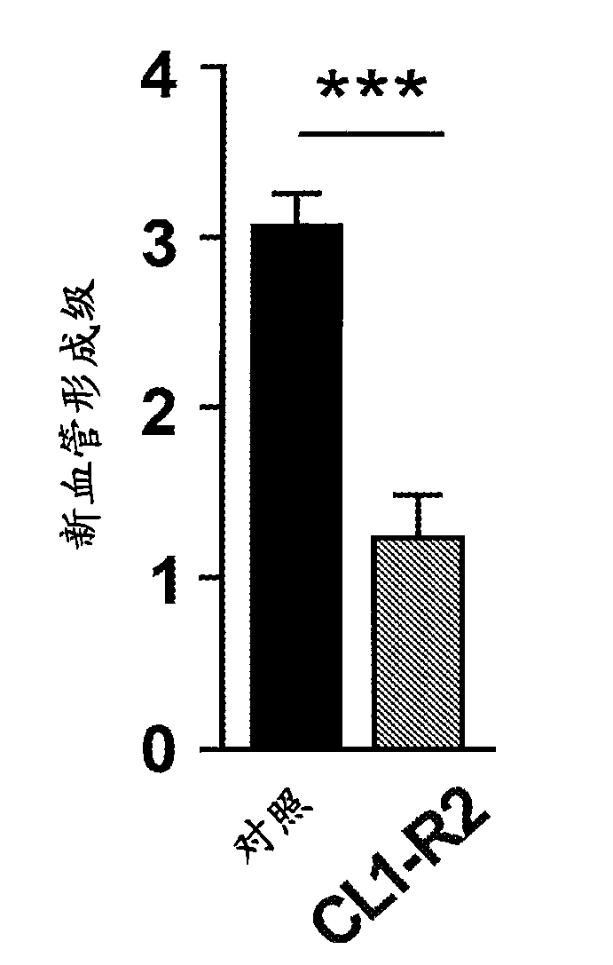 Anti-cd160 specific antibodies for the treatment of eye disorders based on neoangiogenesis