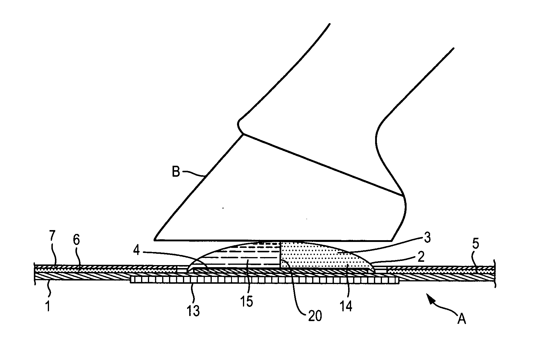 Membrane envelop bandage for application of medicine or ointment