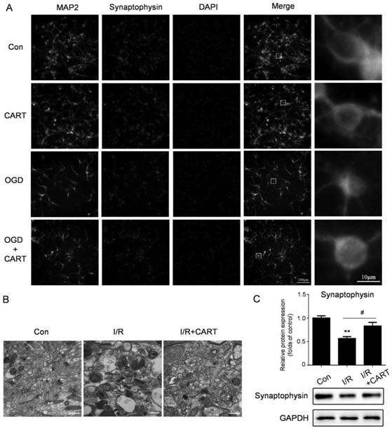 Application of CART to preparation of ischemic brain injury neuroprotective agent medicine