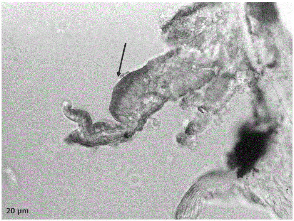 Method of flounder juvenile gonad mRNA in-situ hybridization