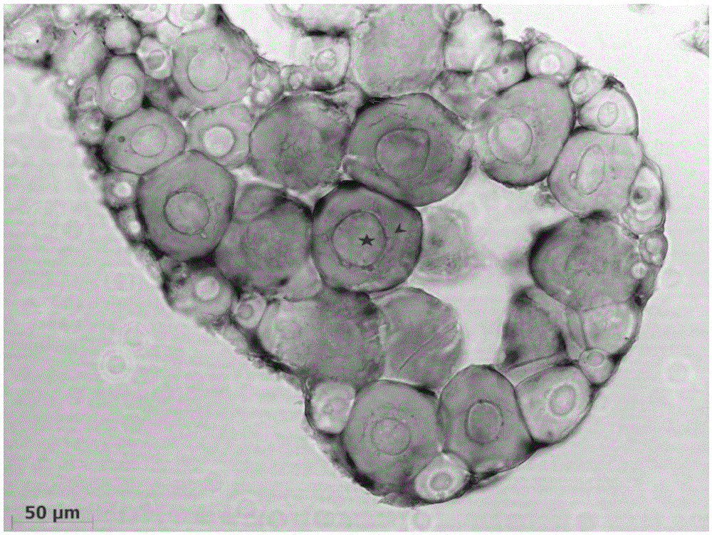 Method of flounder juvenile gonad mRNA in-situ hybridization