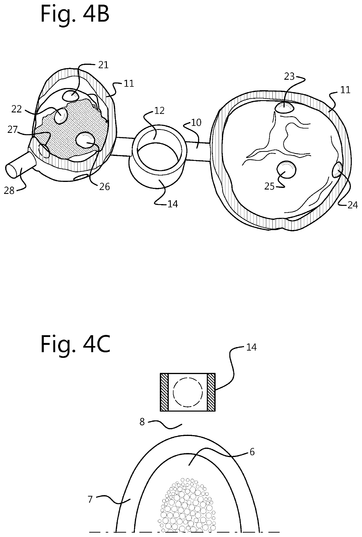 Force-closure or form-closure positioning of surgical templates for guided implant dentistry