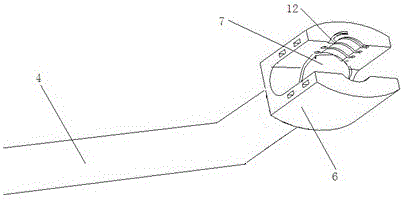 Iliac fixation device