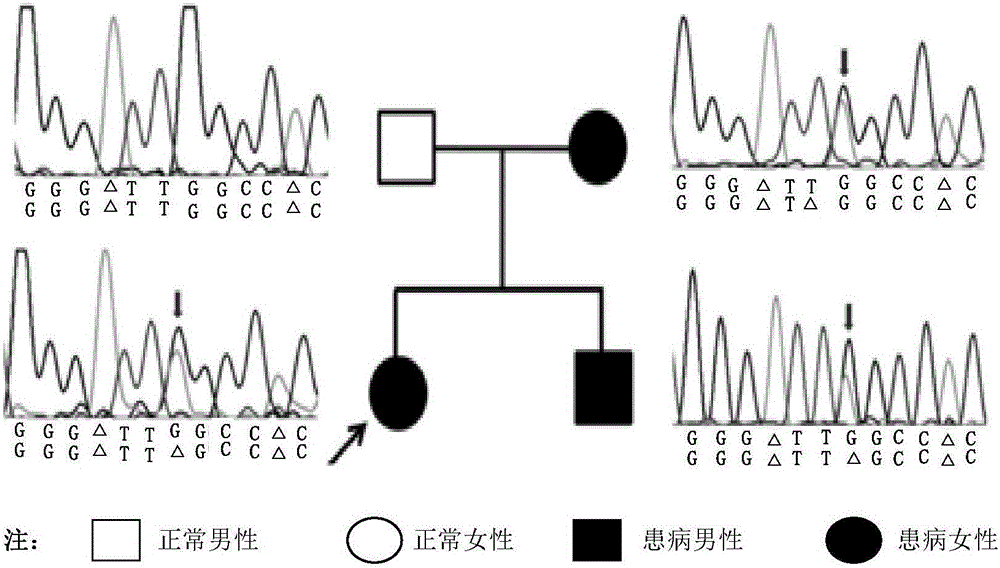 Nervous system genetic disease gene united screening method, kit and preparation method thereof