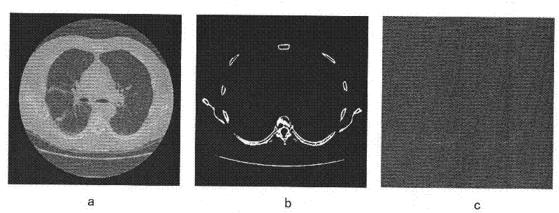 Three-dimensional lung vessel image segmentation method based on geometric deformation model