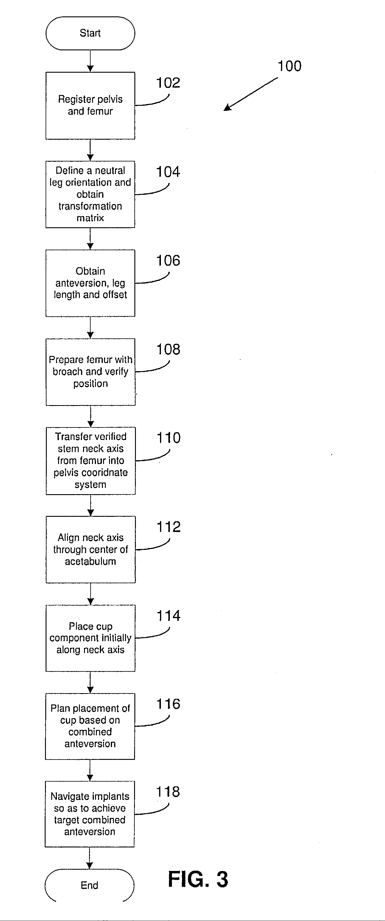 Navigated placement of pelvic implant based on combined anteversion by applying ranawat's sign or via arithmetic formula