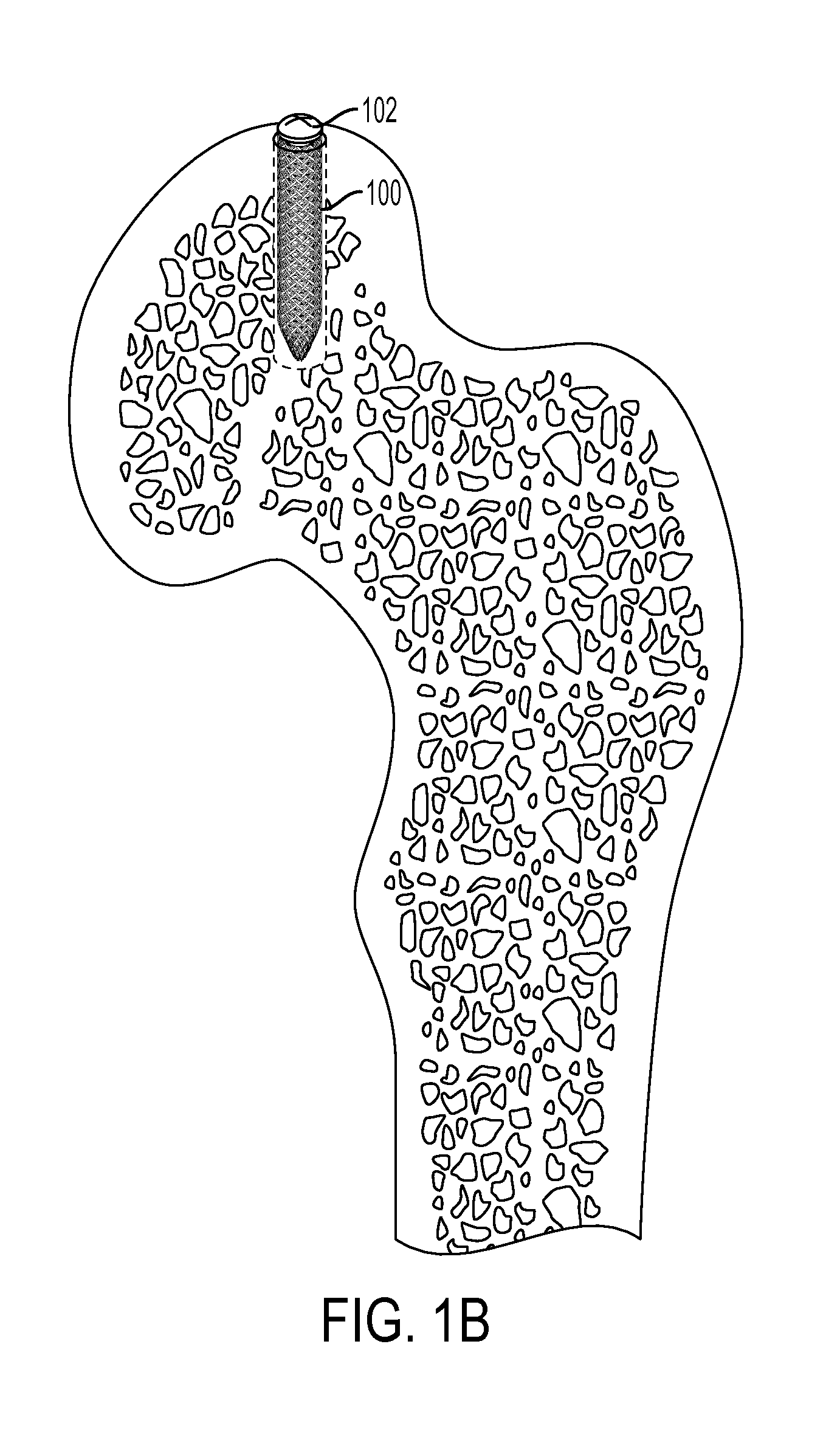 Woven retention devices, systems and methods