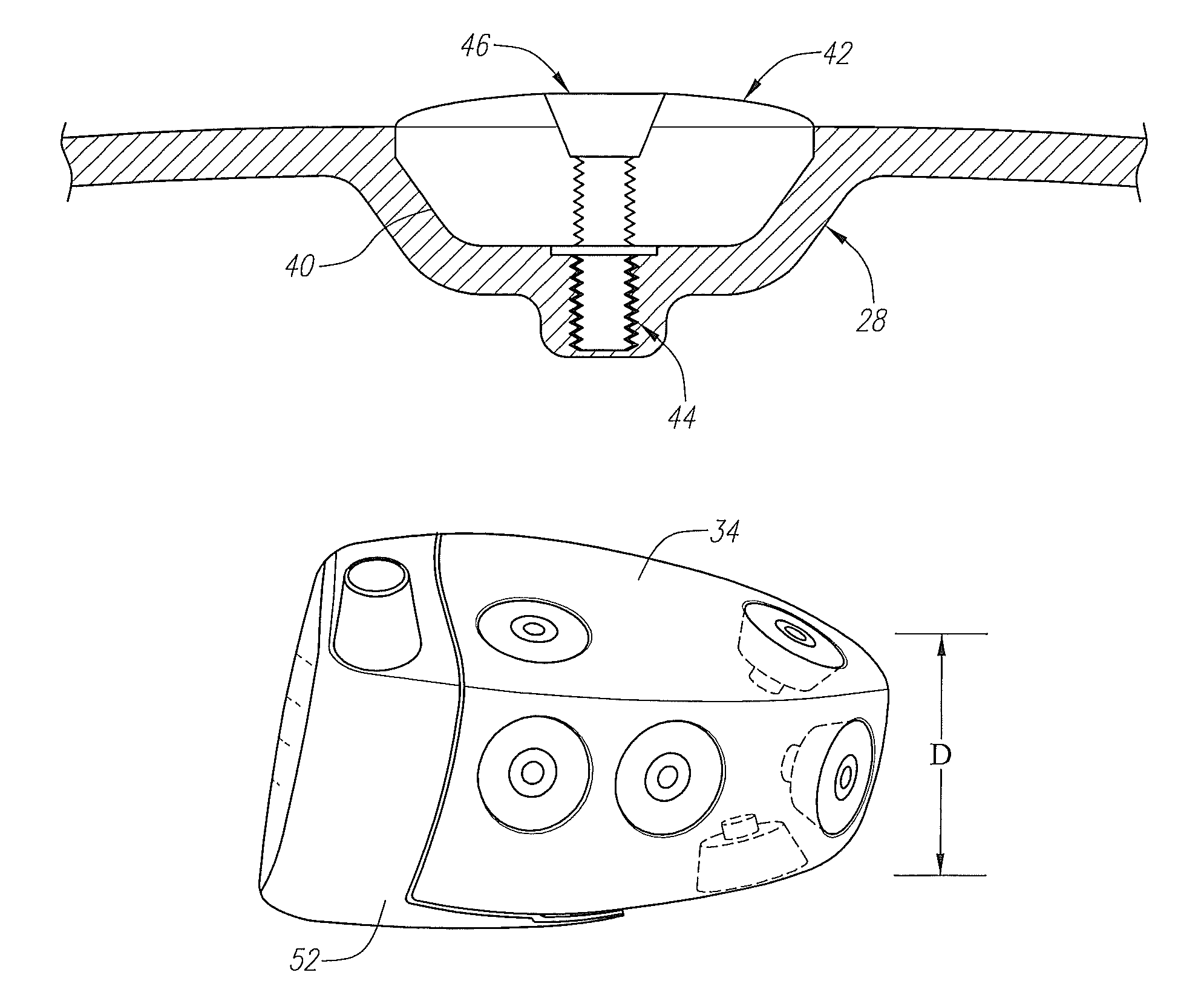 External weight for golf club head