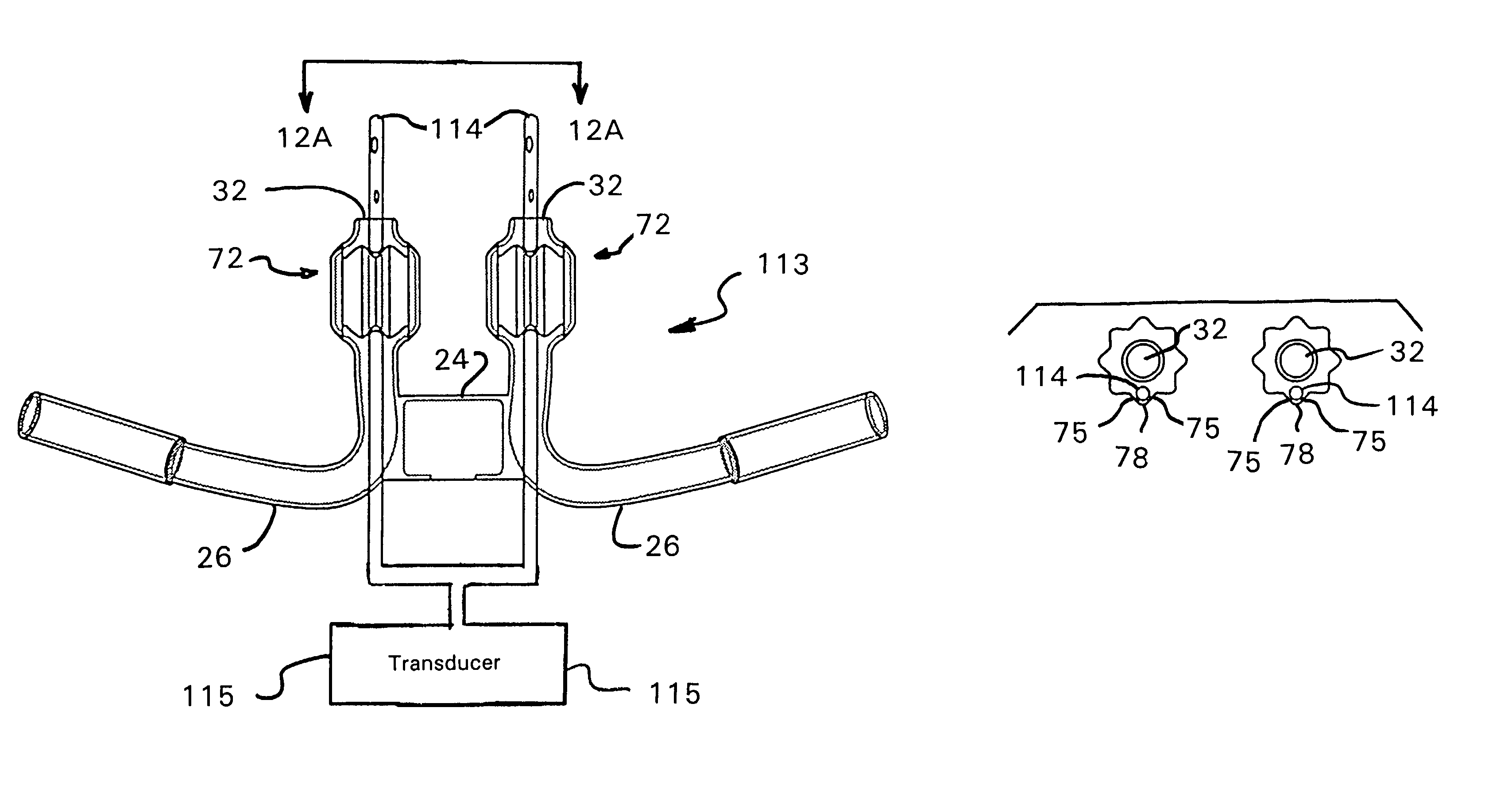 Respiratory therapy system including a nasal cannula assembly