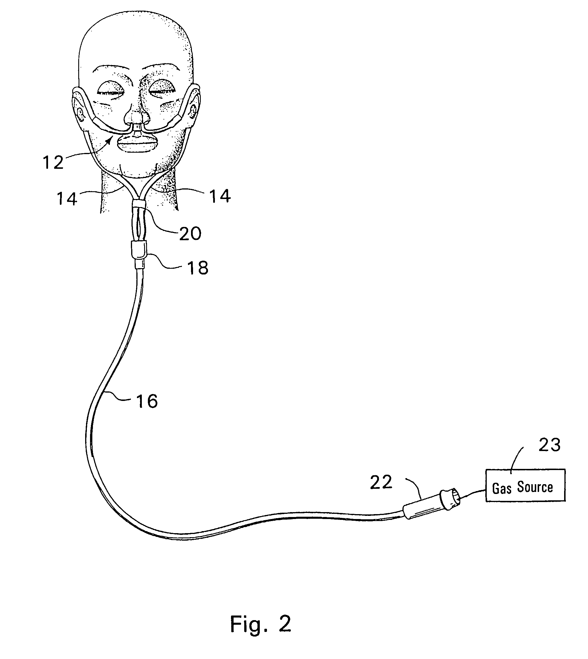 Respiratory therapy system including a nasal cannula assembly