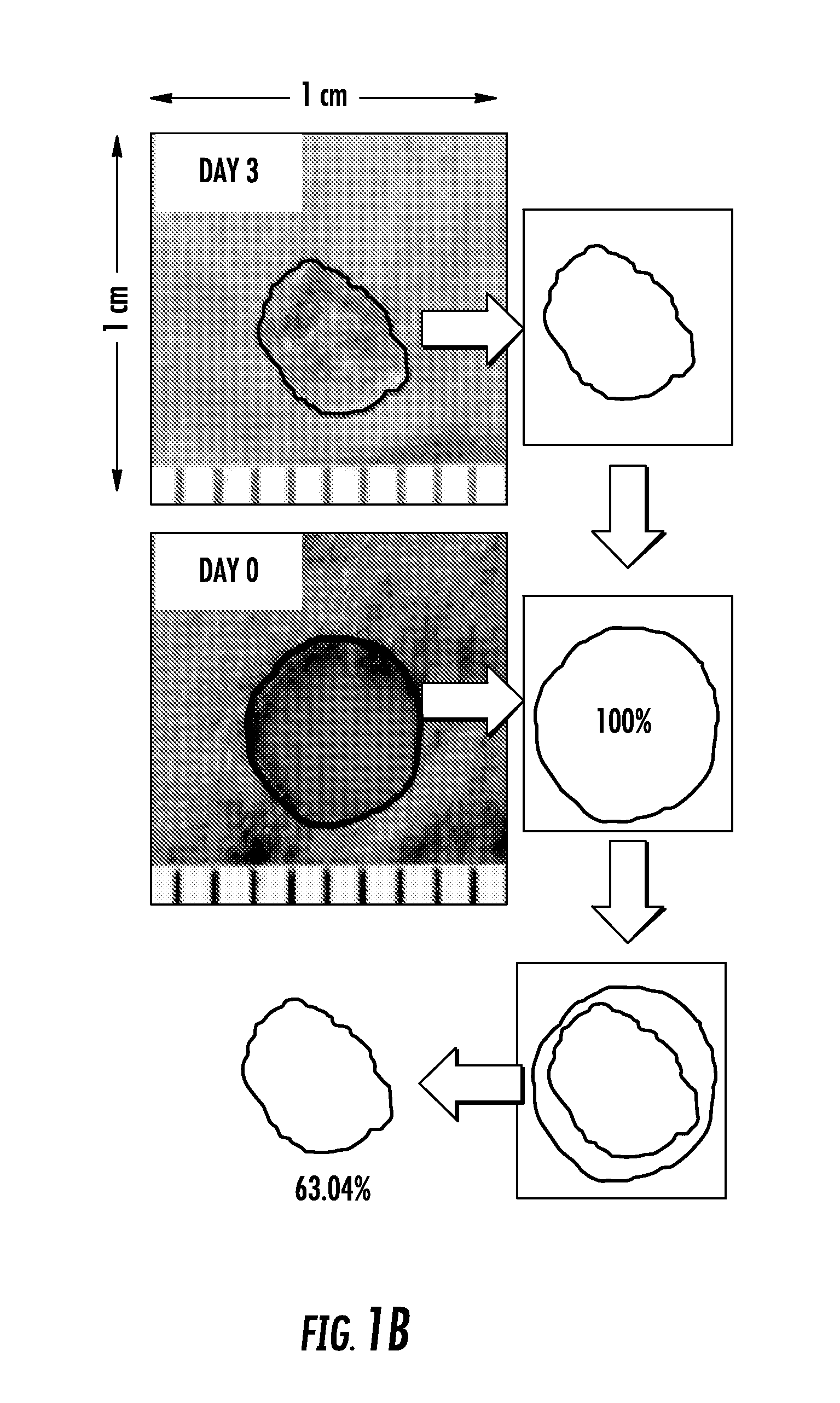 Wound healing via autologous stem cell mobilization