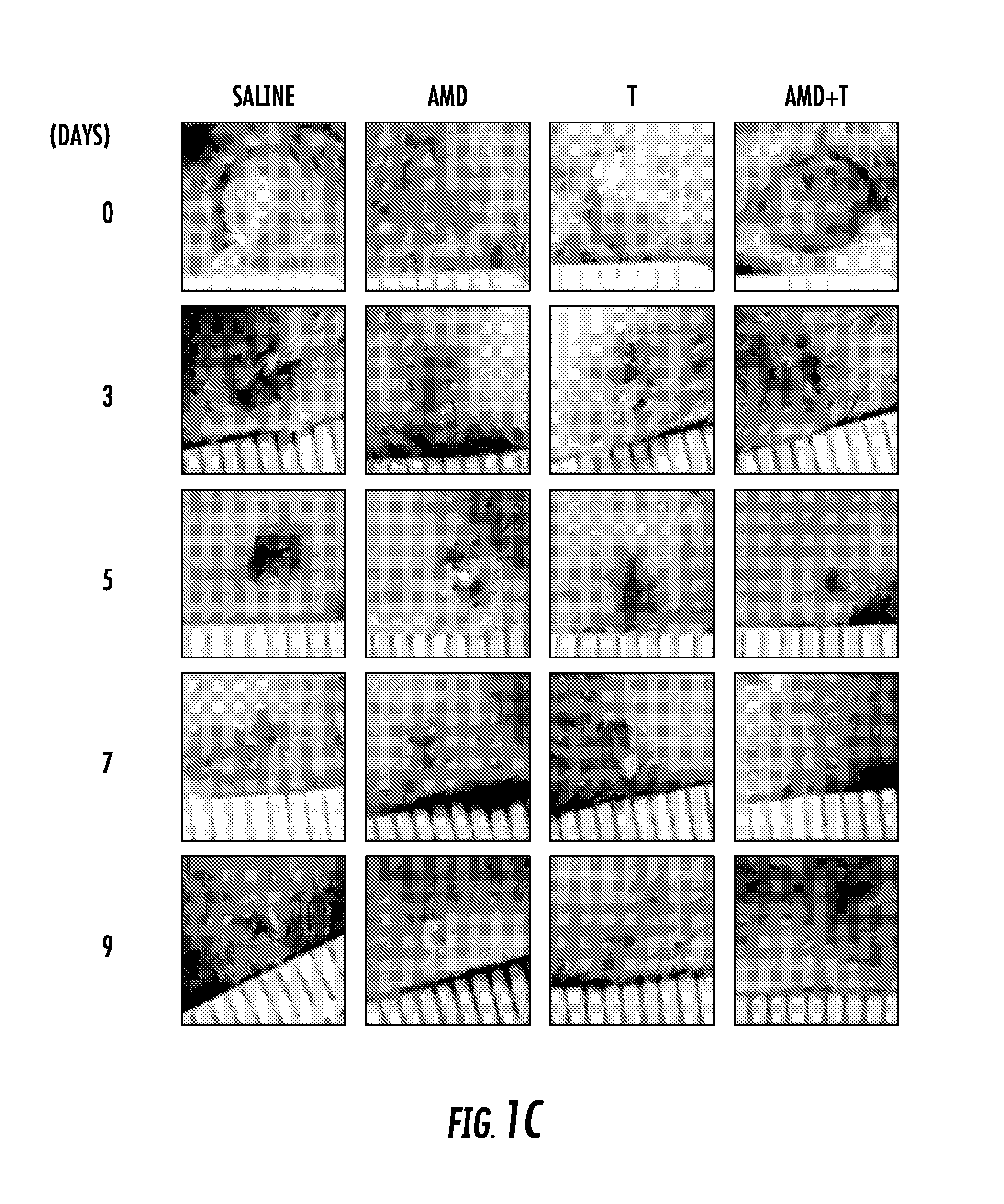 Wound healing via autologous stem cell mobilization