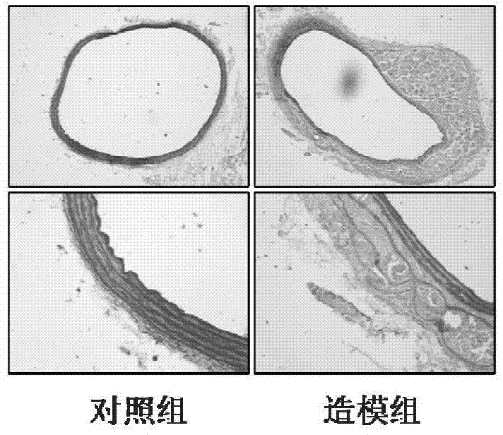 Establishing method and application of mouse aortic dissecting aneurysm model