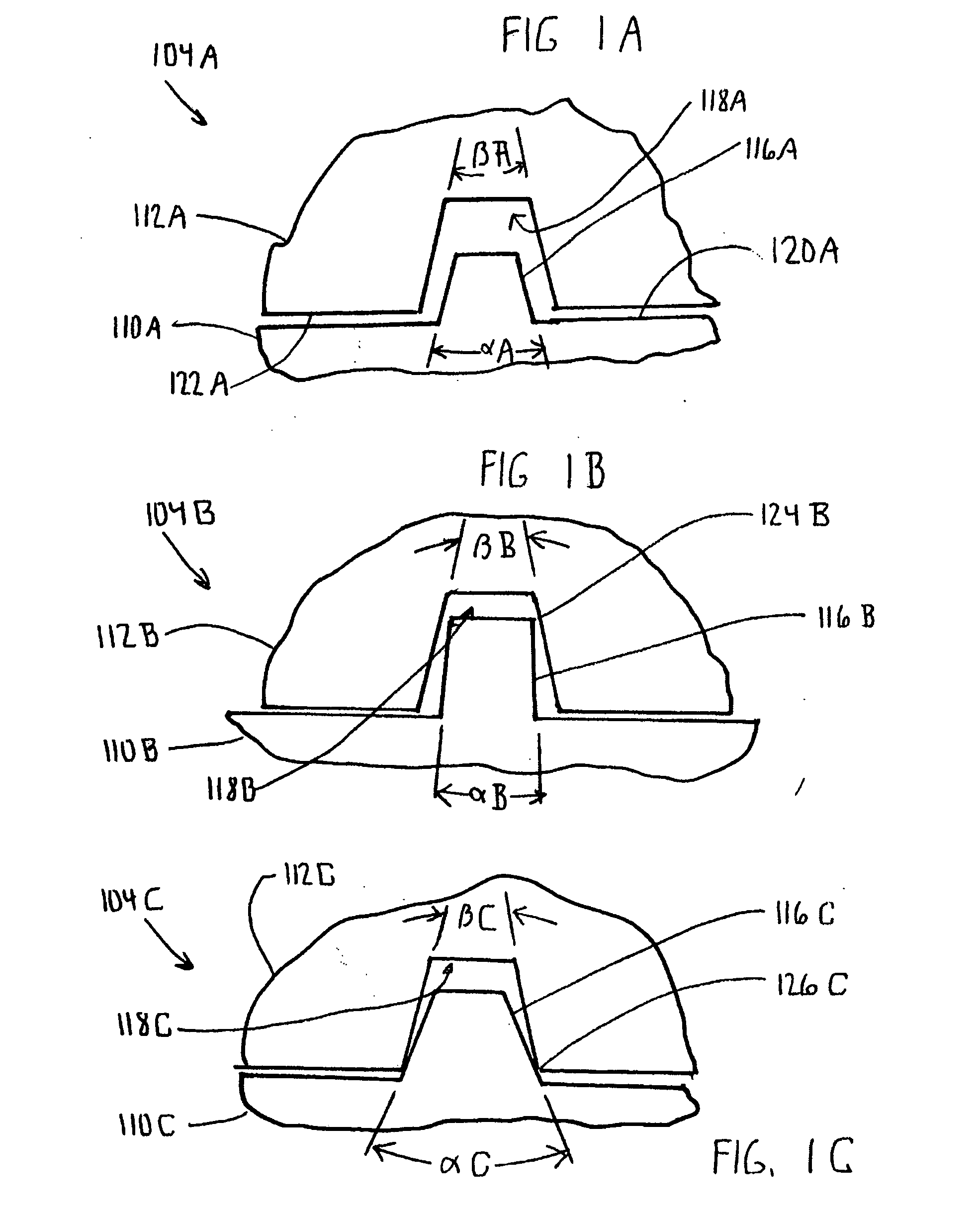 Mobile bearing total elbow prosthesis, ulnar component, and associated kit