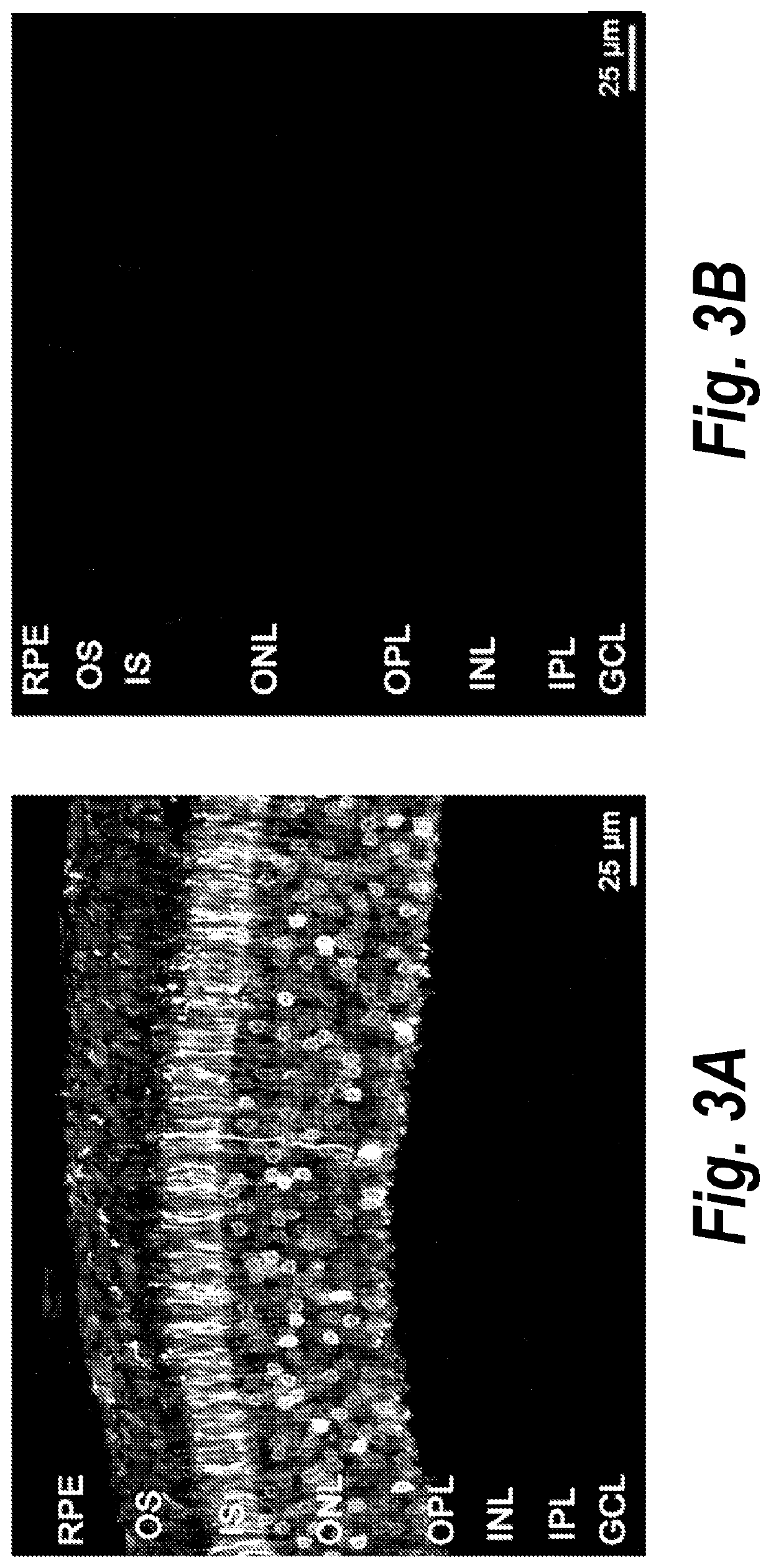 Gene Therapy for the Treatment of CNGB1-linked Retinitis Pigmentosa