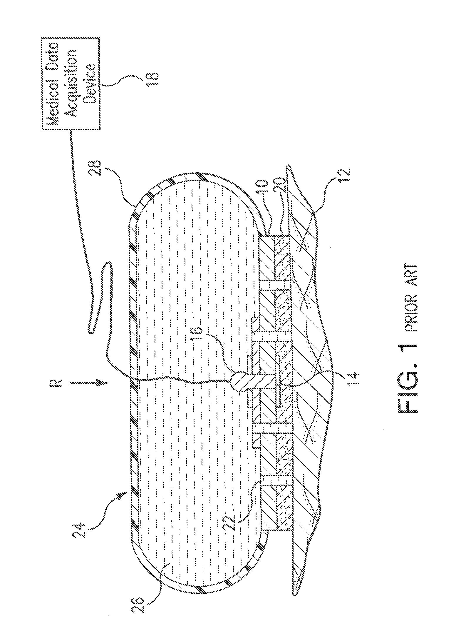 Quick-release self-contained medical electrode