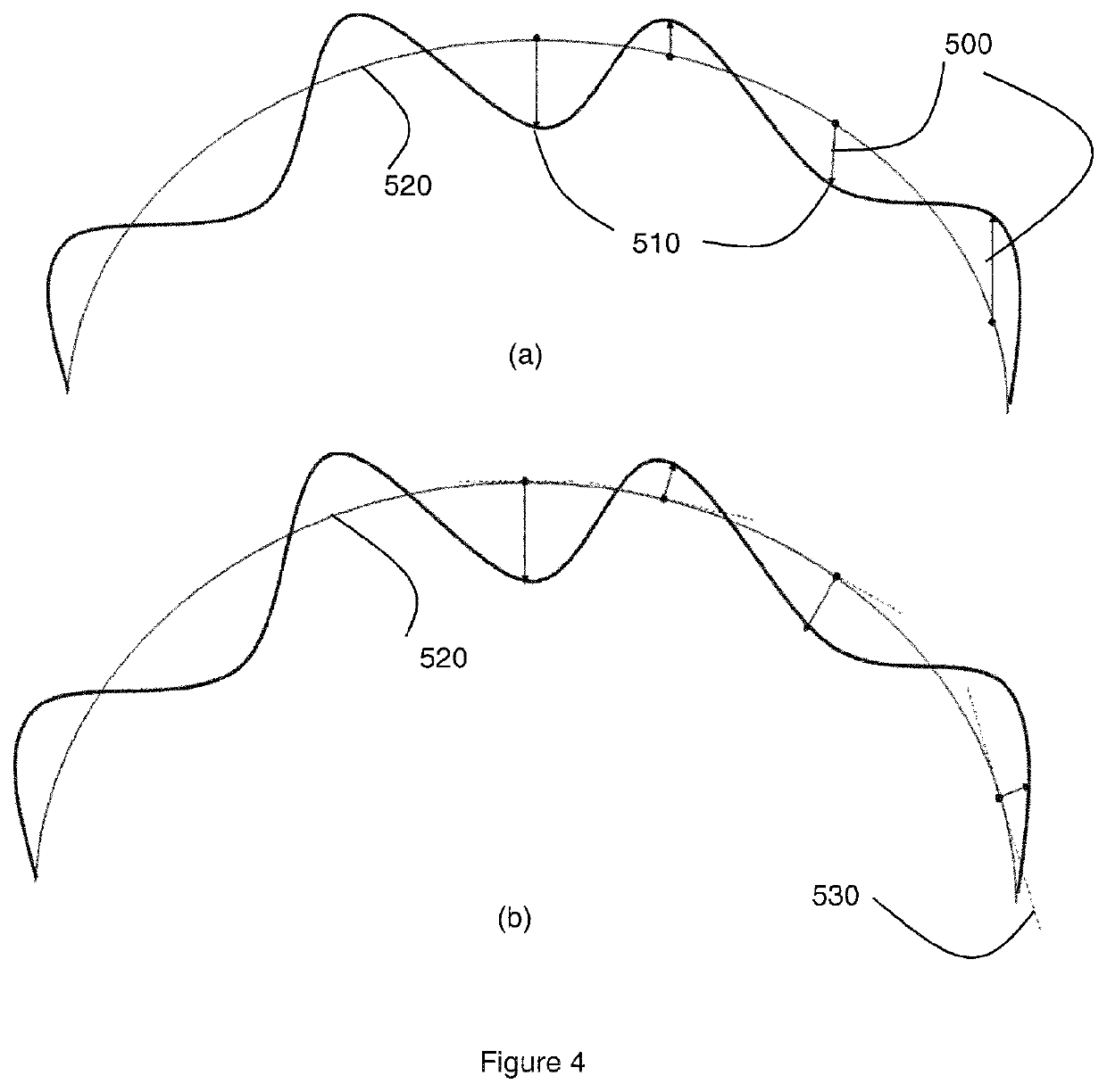 Determining global shape parameters of a cornea using a two-fold fitting from measurement data to an aspheric toric surface model