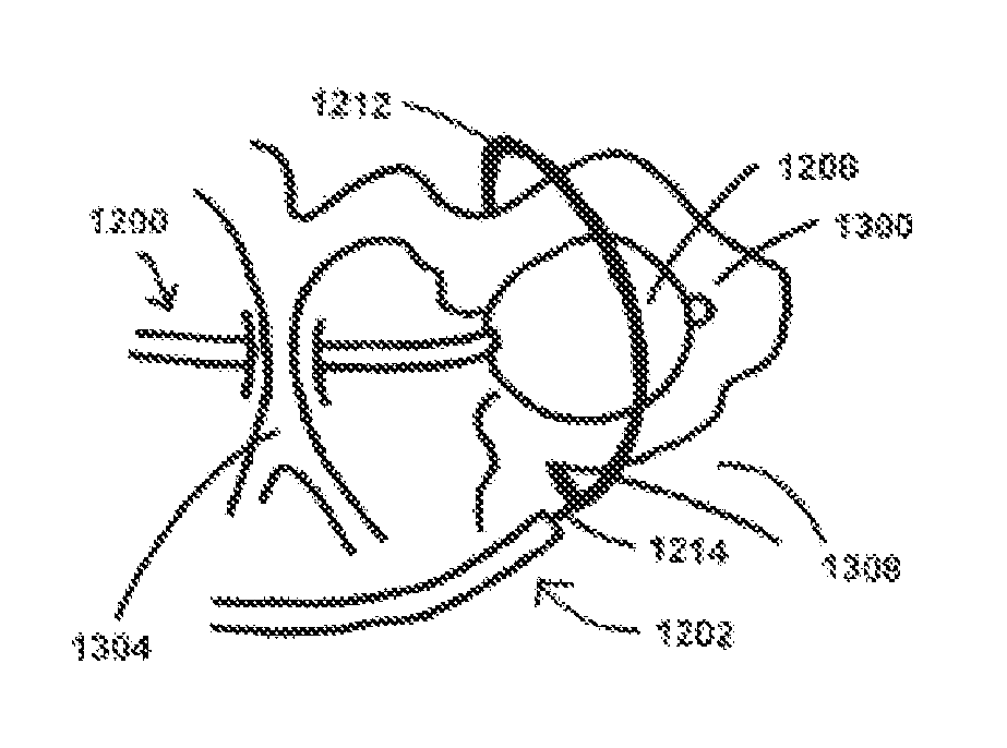 Devices, systems, and methods for atrial appendage occlusion using light cure