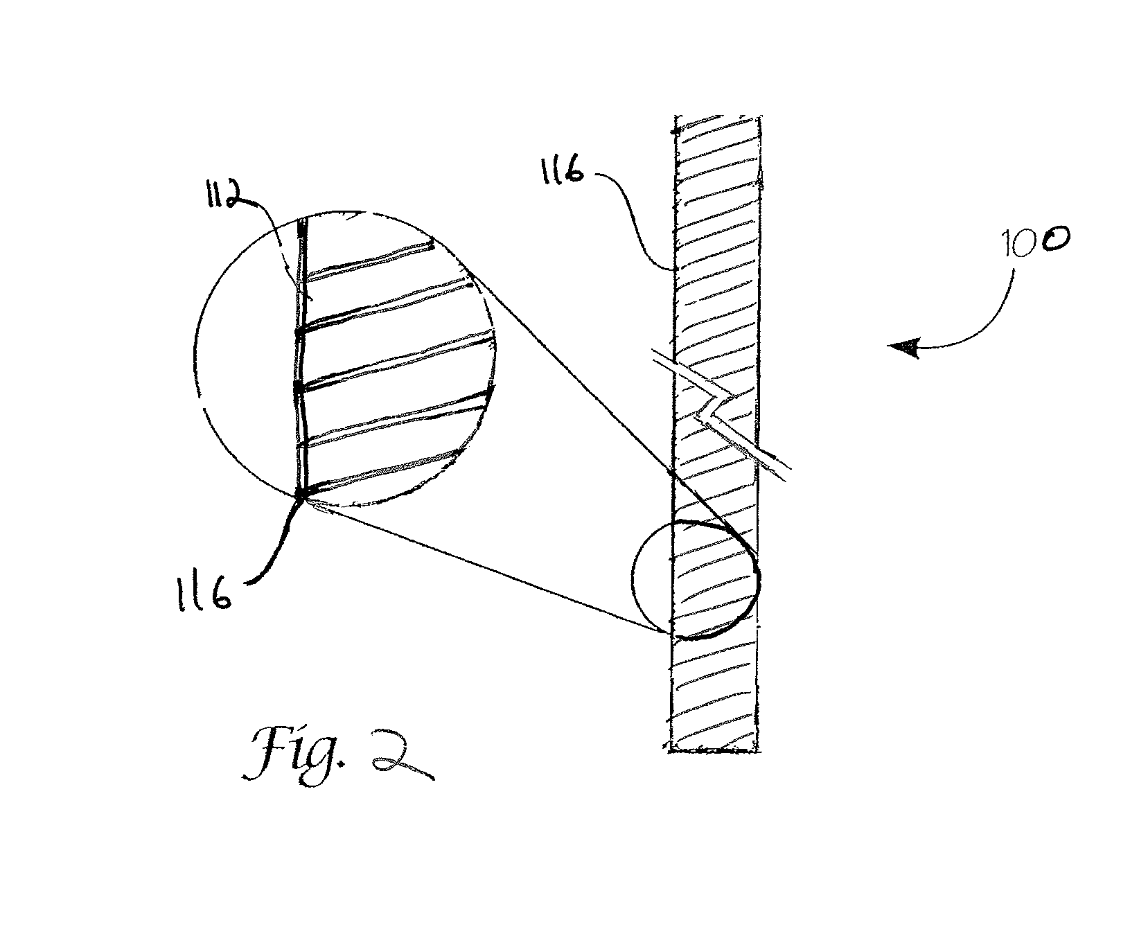 Absorbable endo-urological devices and applications therefor