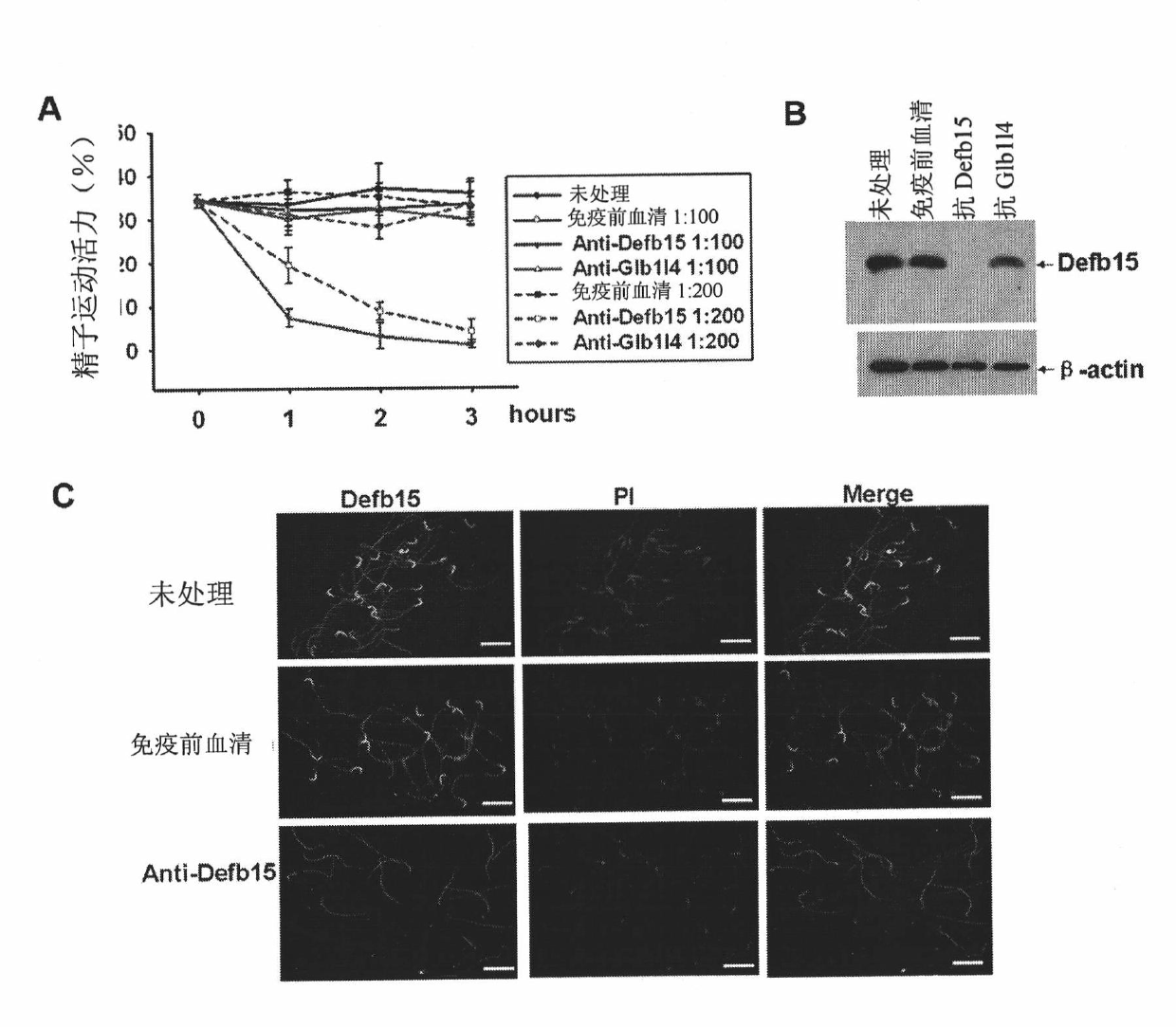 Beta-defensin 15 of specific antibacterial peptides of rat epididymis and application thereof