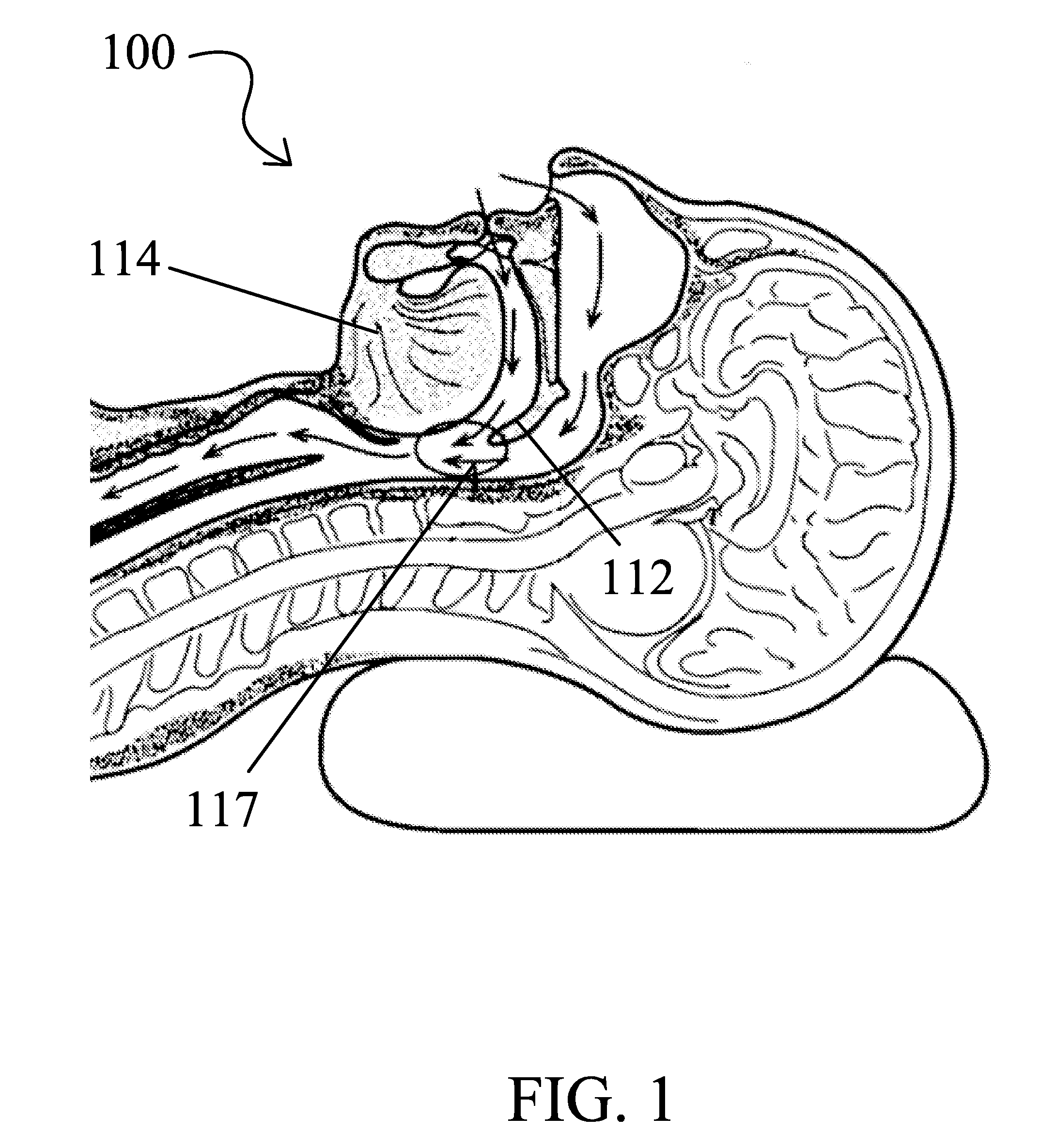 Snoring and obstructive sleep apnea prevention and treatment device