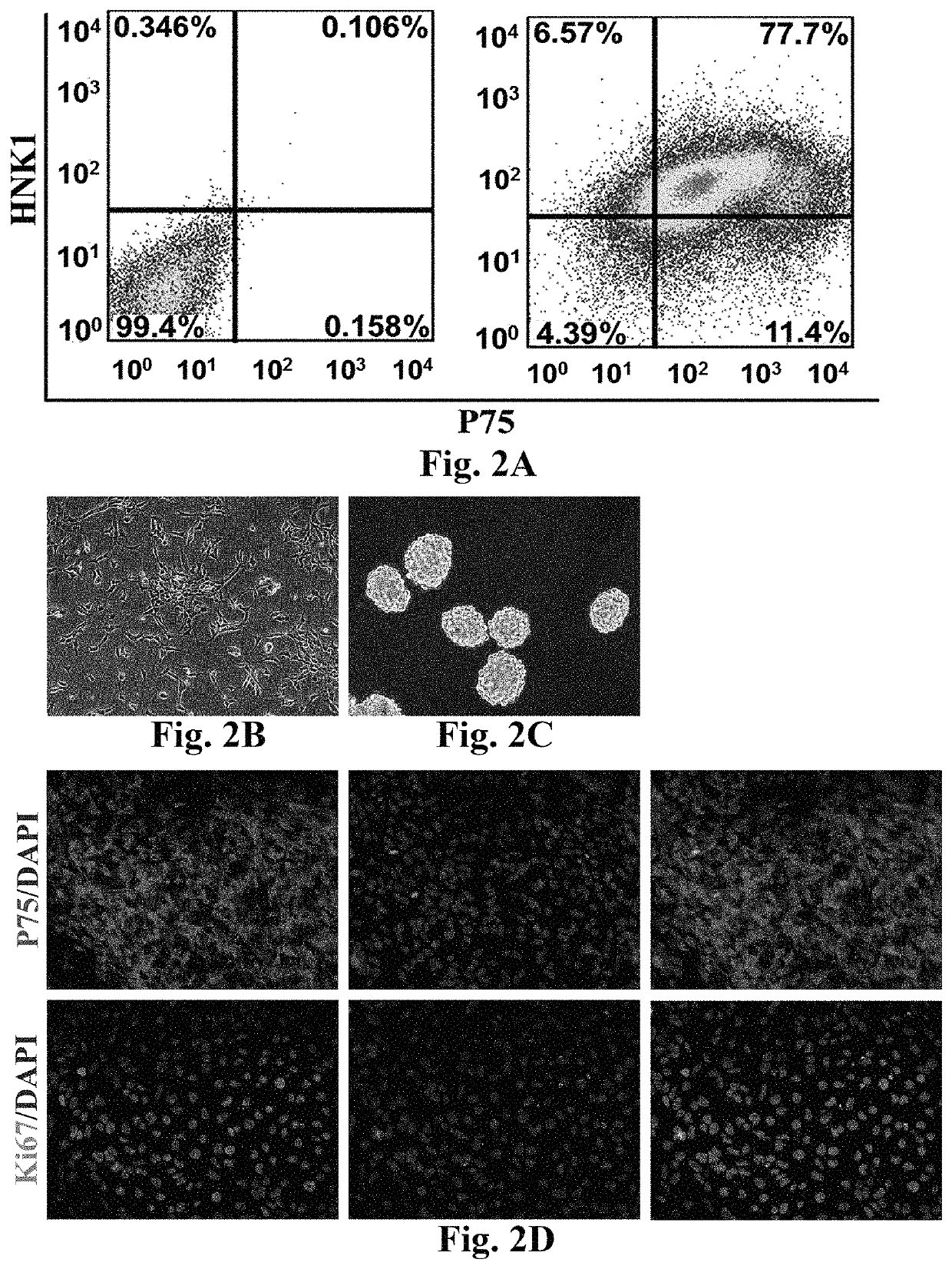 Method of committed differentiation of human induced pluripotent stem cells into Leydig cells and application of Leydig cells