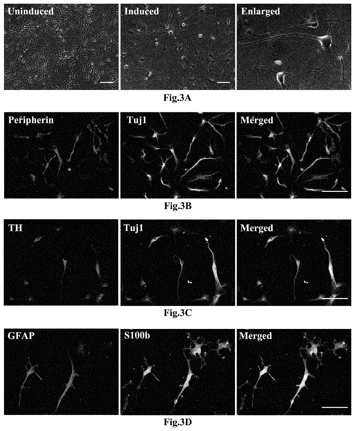 Method of committed differentiation of human induced pluripotent stem cells into Leydig cells and application of Leydig cells