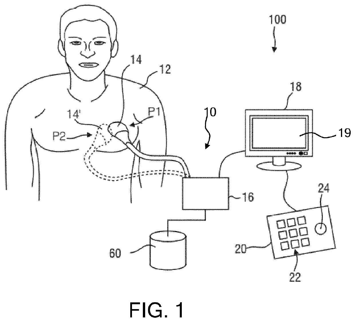 Anatomical measurements from ultrasound data