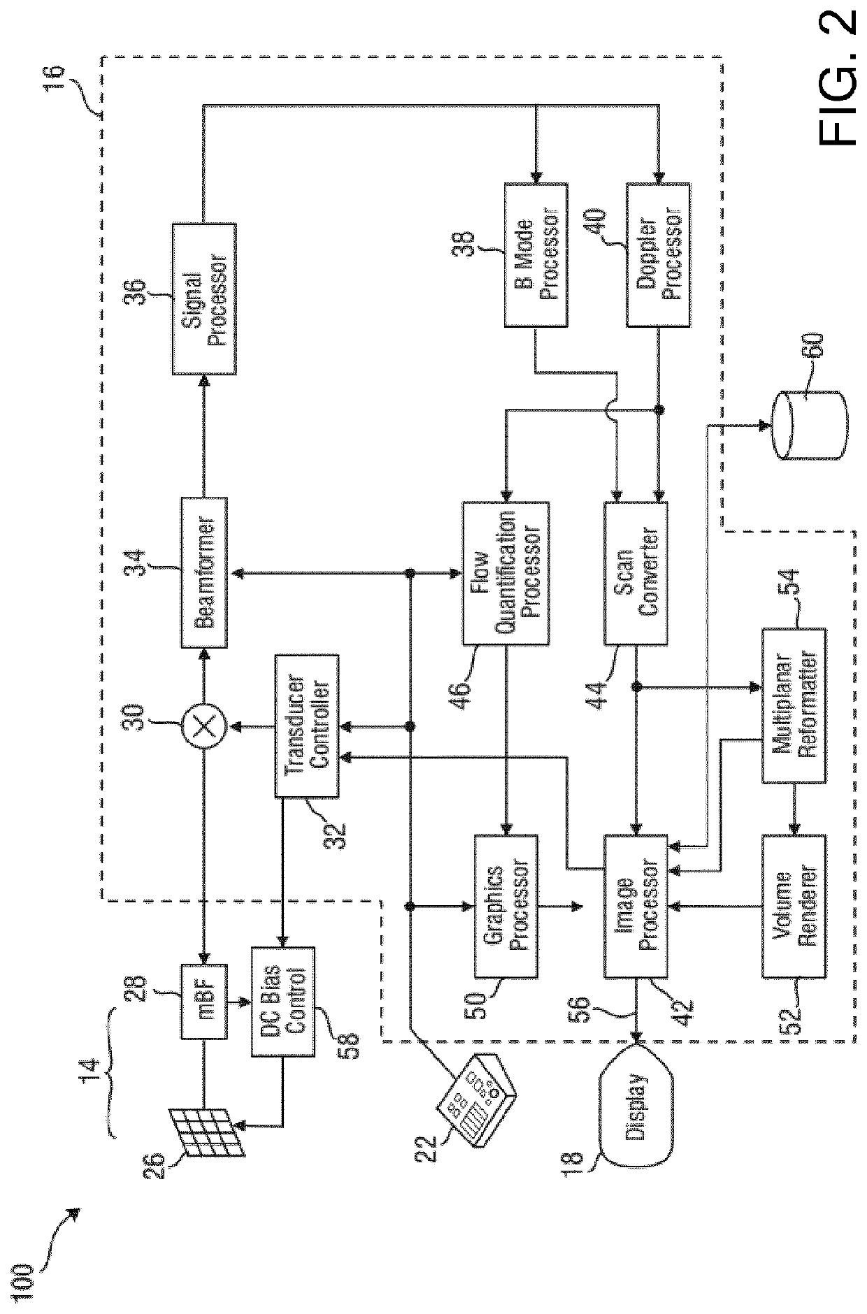 Anatomical measurements from ultrasound data