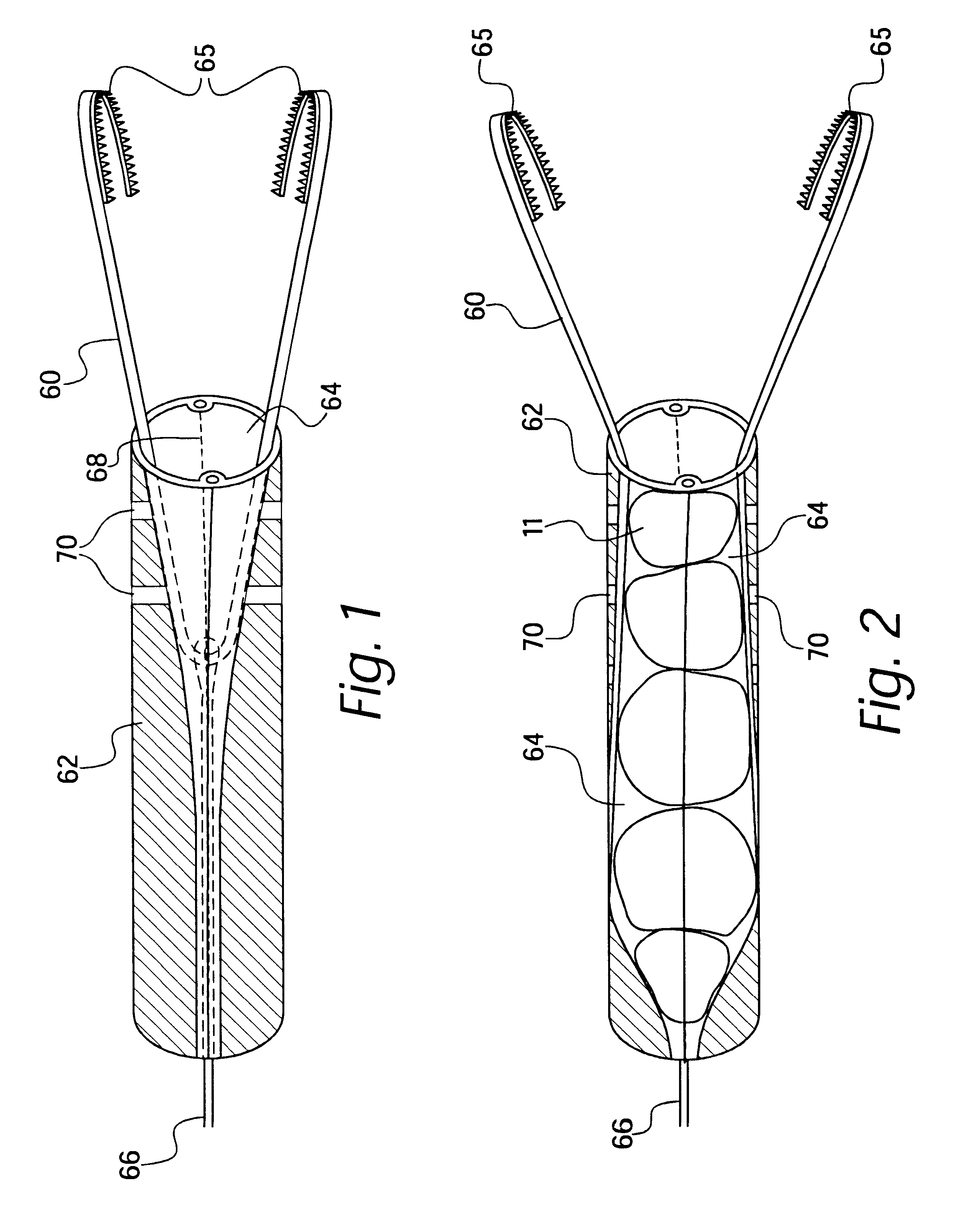 Apparatus for separable external serial collection, storage and processing of biopsy specimens