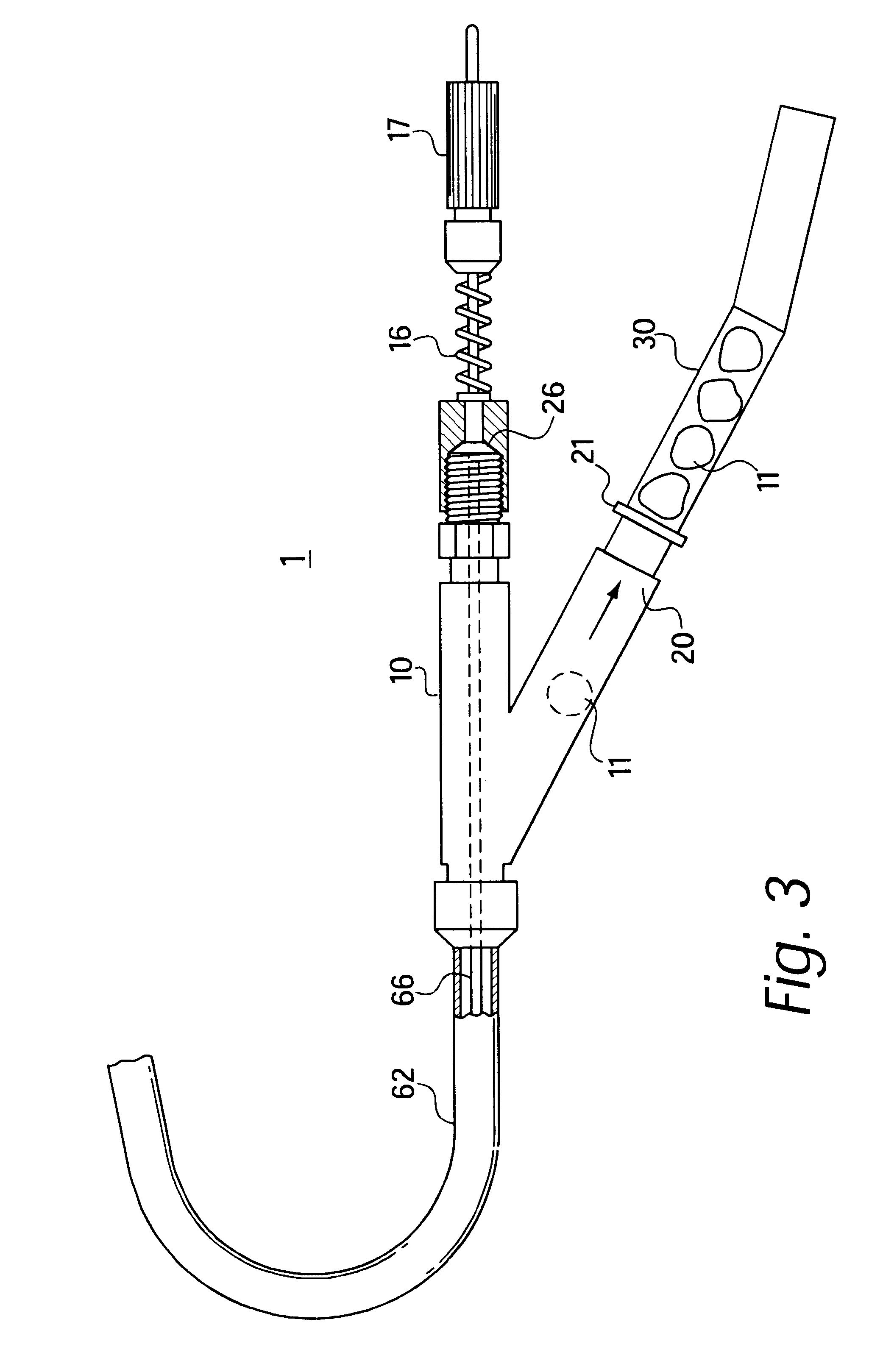 Apparatus for separable external serial collection, storage and processing of biopsy specimens