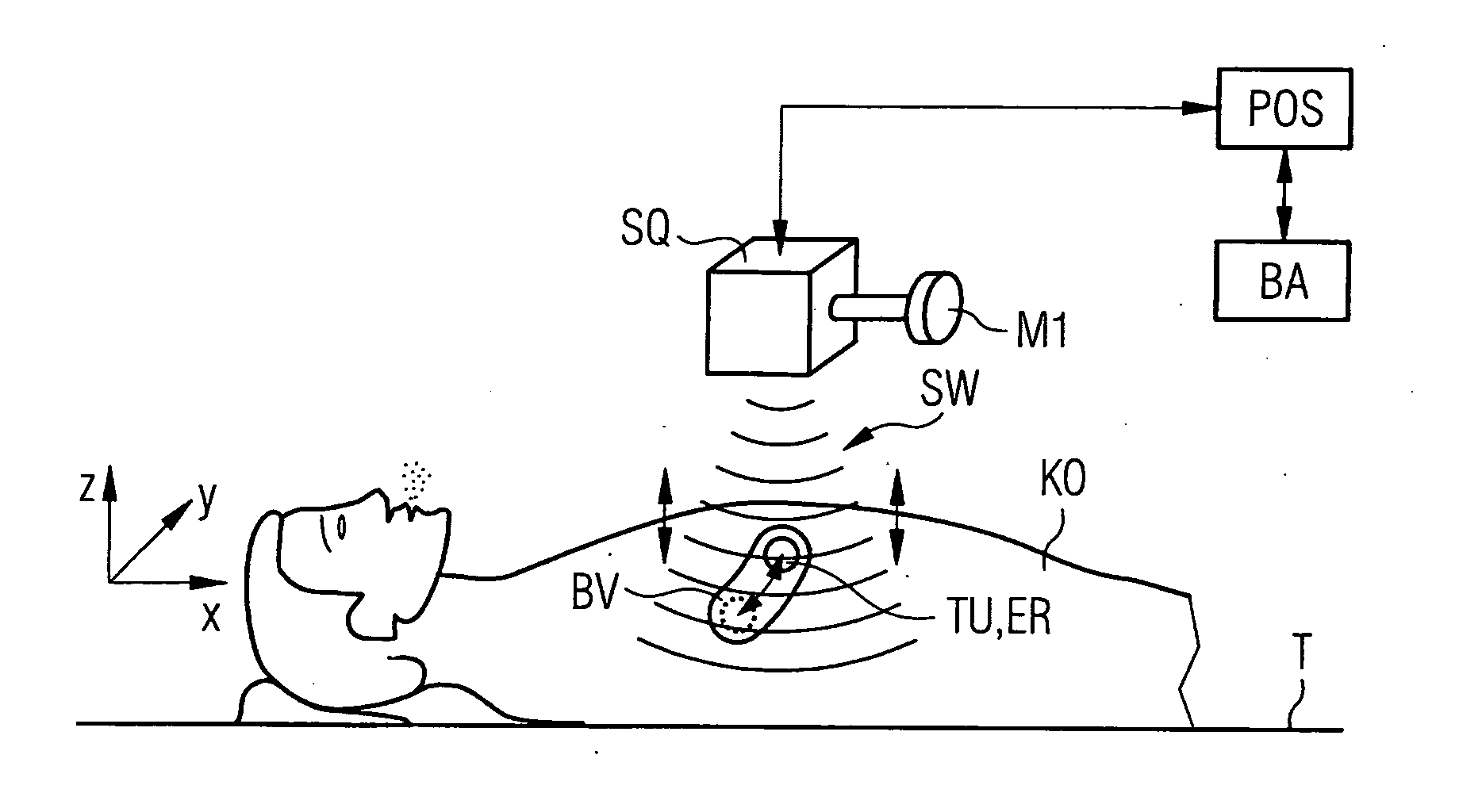 Device for spatial localization of a movable part of the body