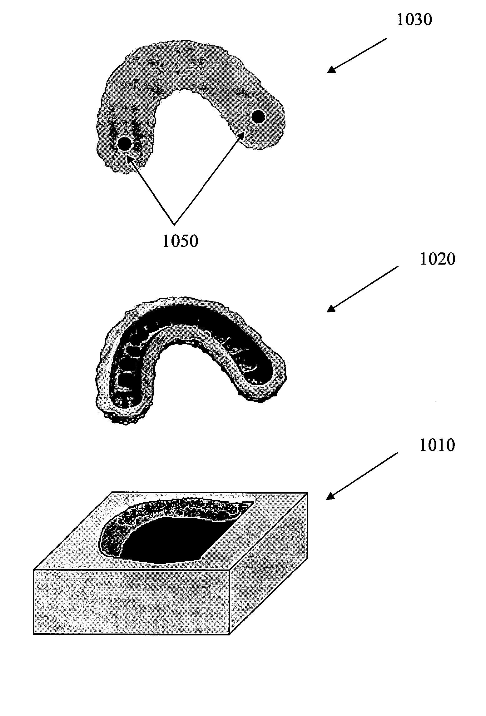 Producing a physical toothmodel compatible with a physical dental arch model