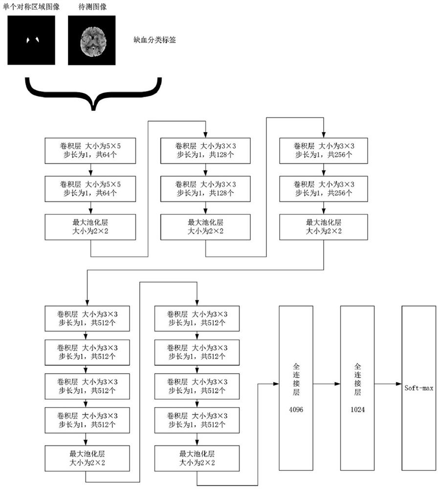 Method for calculating ASPECTS score of non-enhanced CT