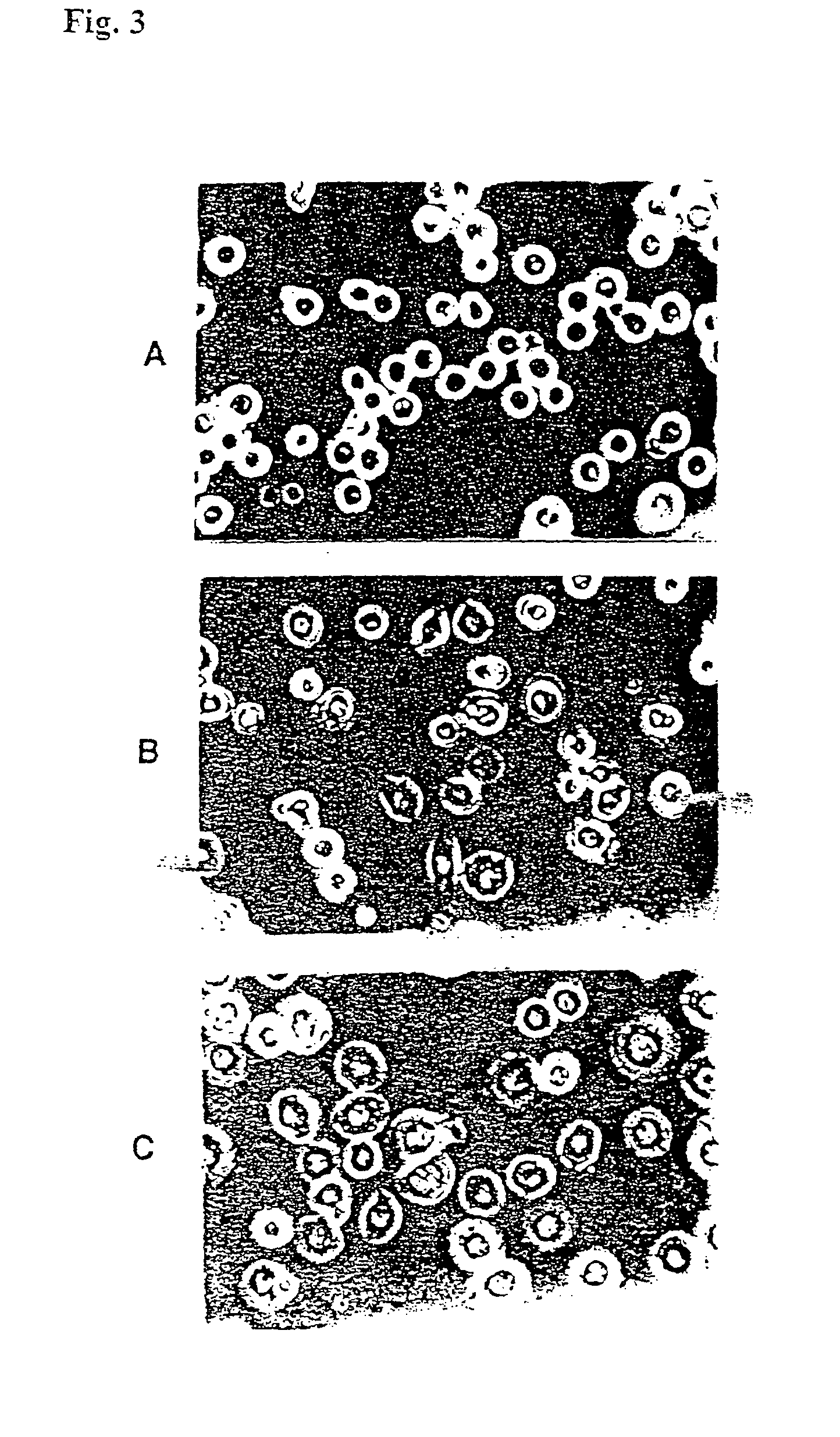 Soluble recombinant αvβ3 adhesion receptor