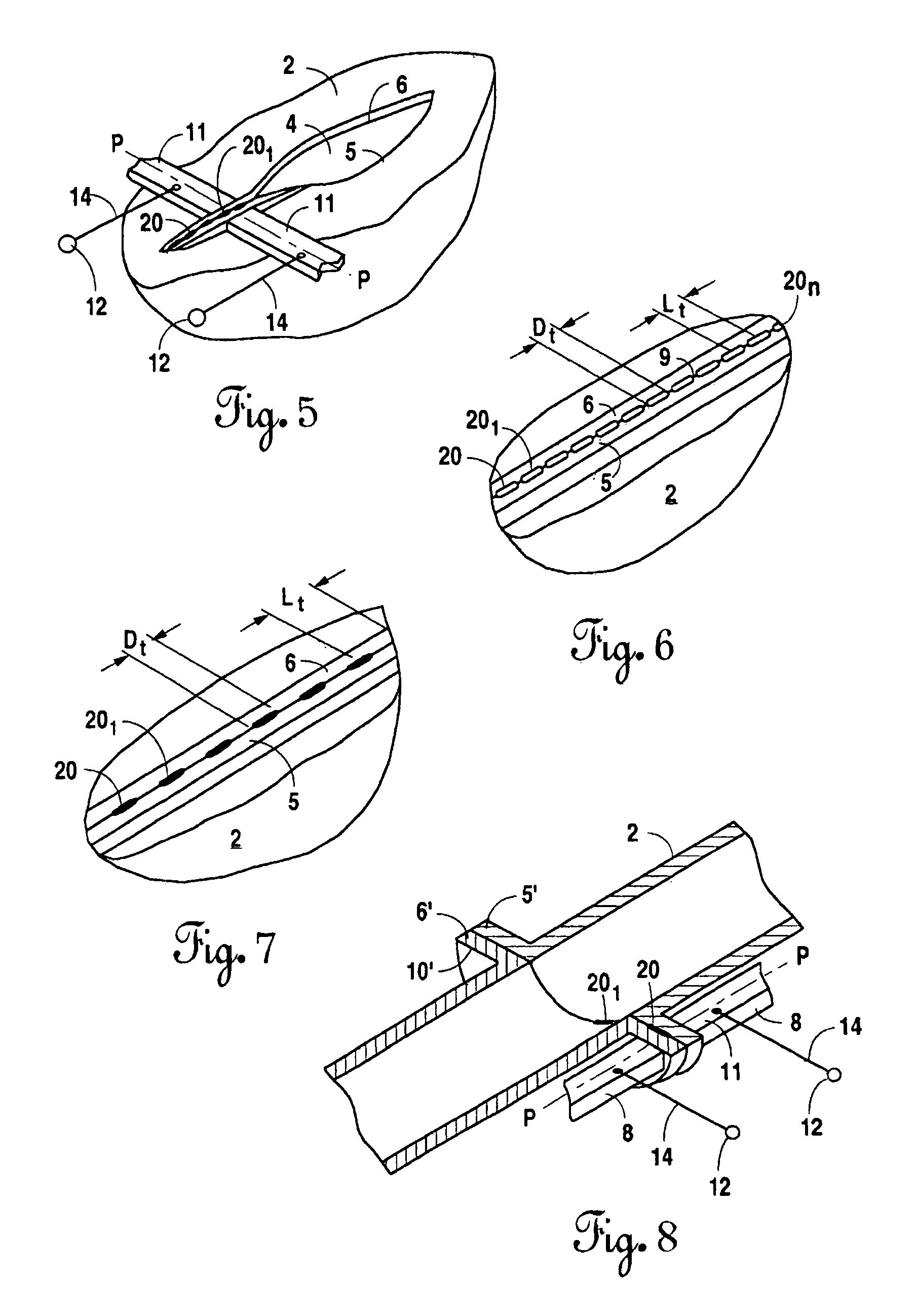 Instrument and method for the end-to-end reconnection of intestinal tissues