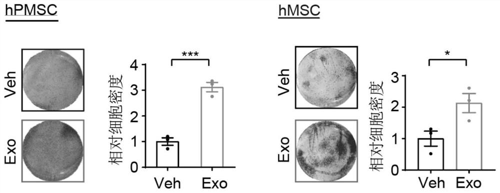 Application of atler stem cell exosome in preparation of products for improving or treating osteoarthritis and delaying cell senescence