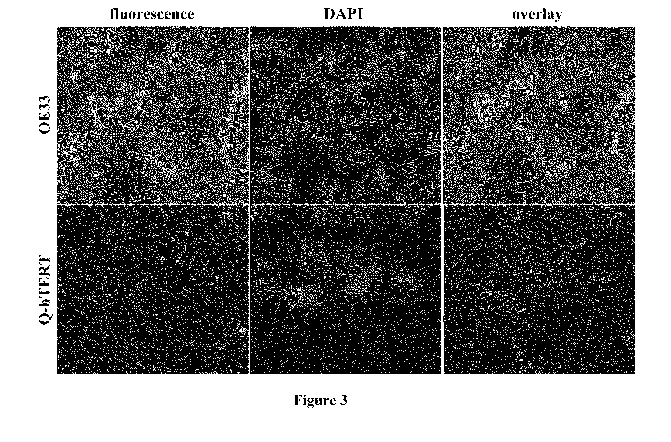 Targeted Detection of Dysplasia In Barrett's Esophagus With A Novel Fluorescence-Labeled Polypeptide