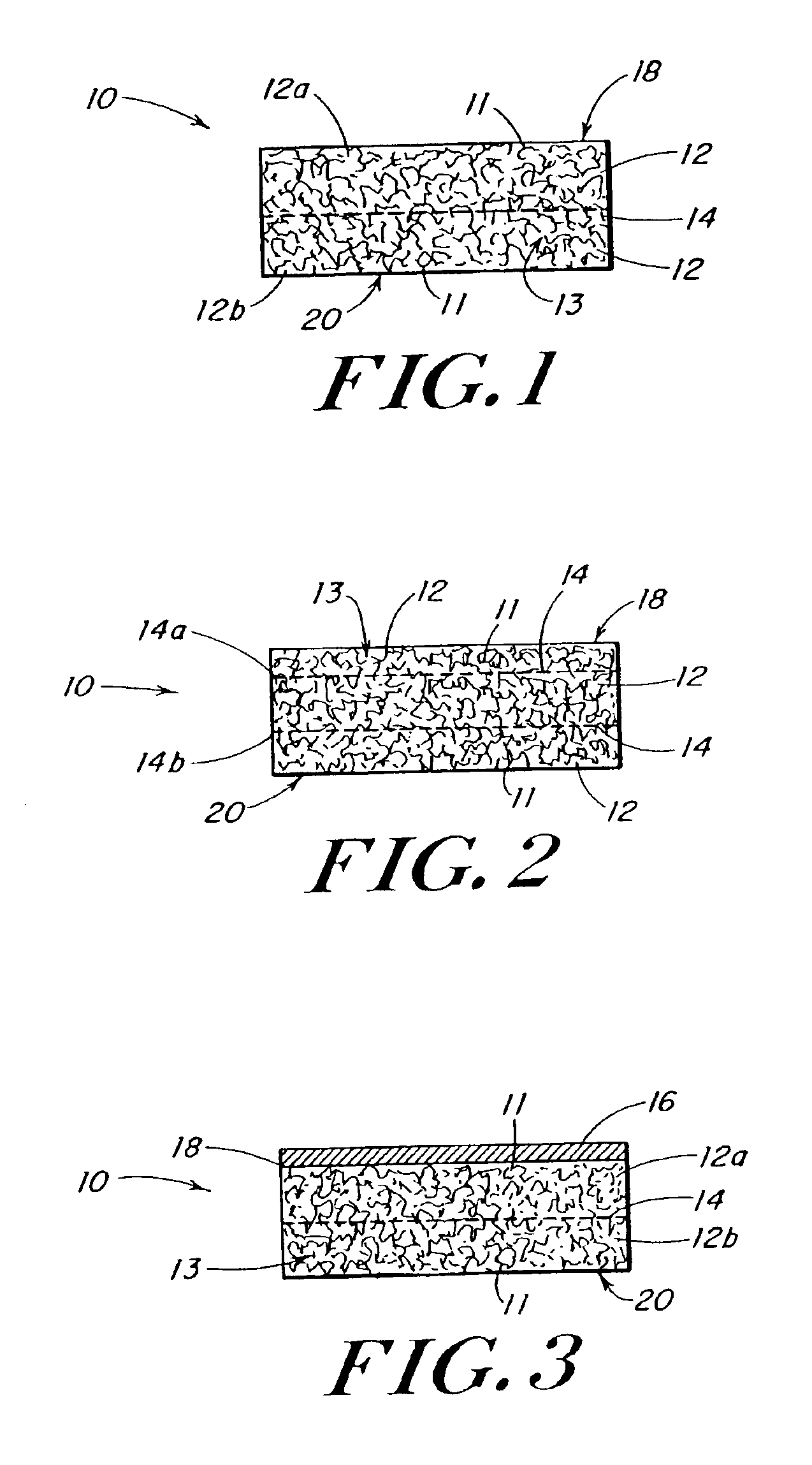 Use of reinforced foam implants with enhanced integrity for soft tissue repair and regeneration