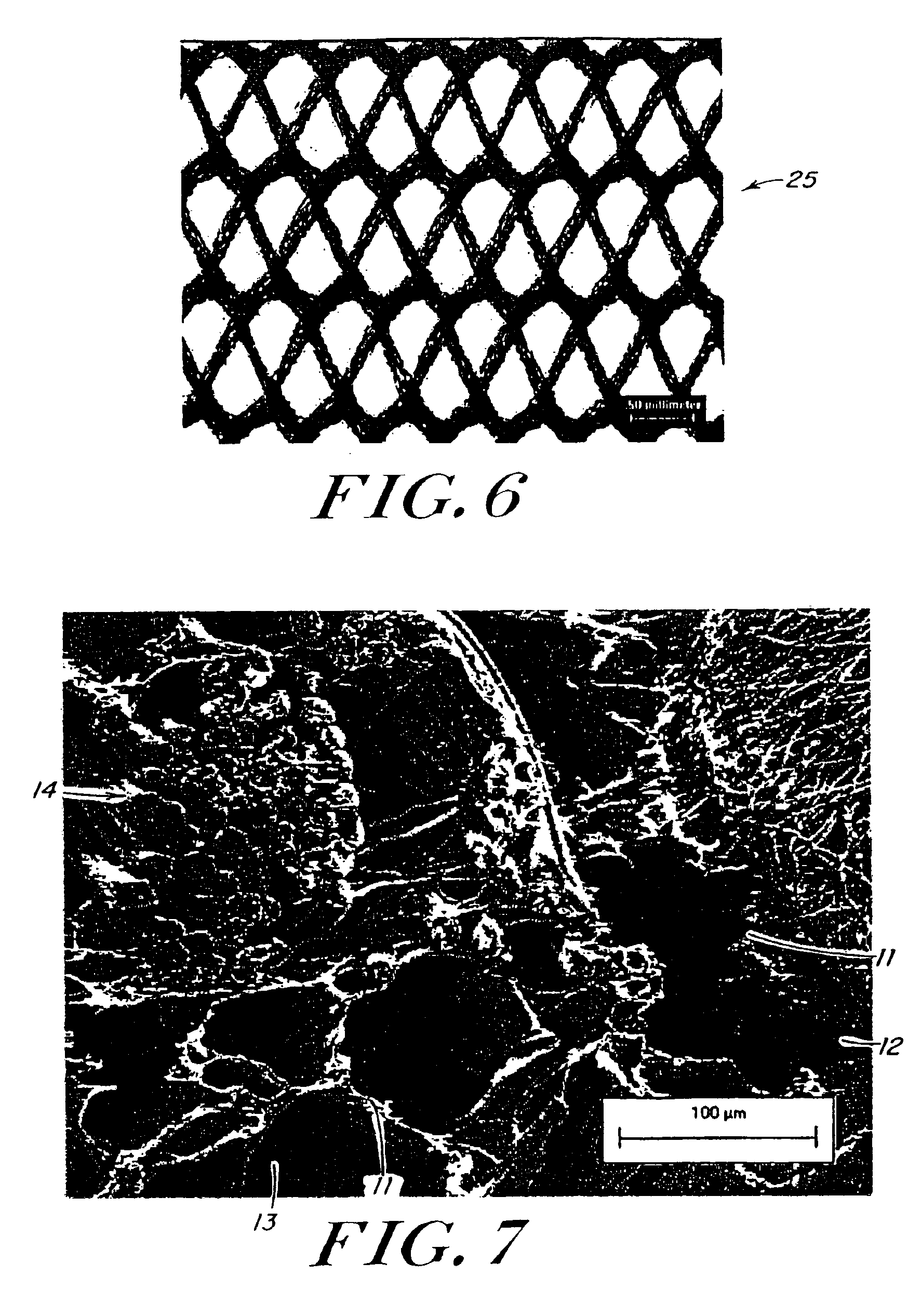 Use of reinforced foam implants with enhanced integrity for soft tissue repair and regeneration