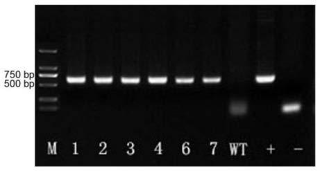 Salt tolerance gene hgs2 of halophytic grass and its application