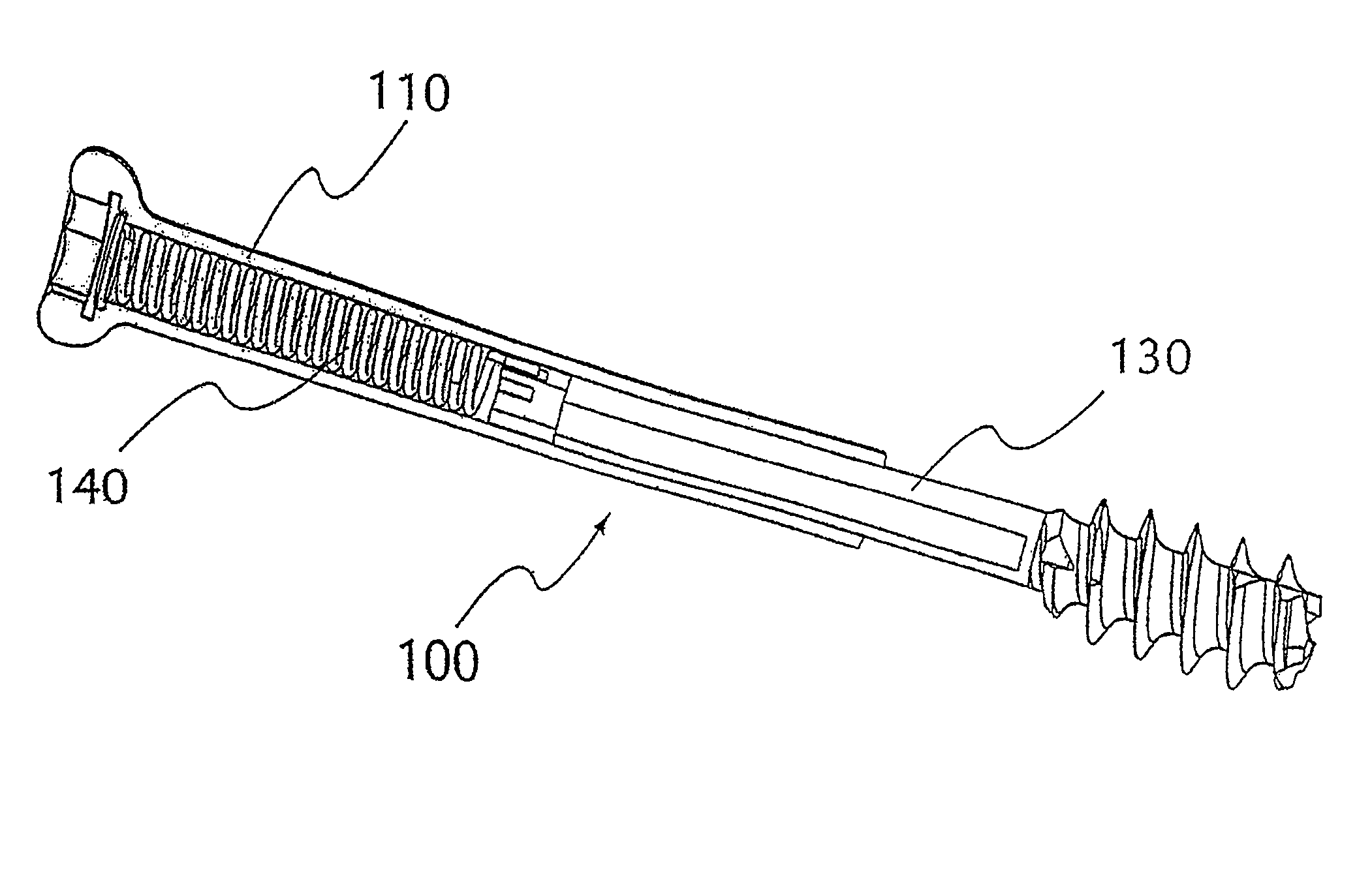 Bone screw system and method