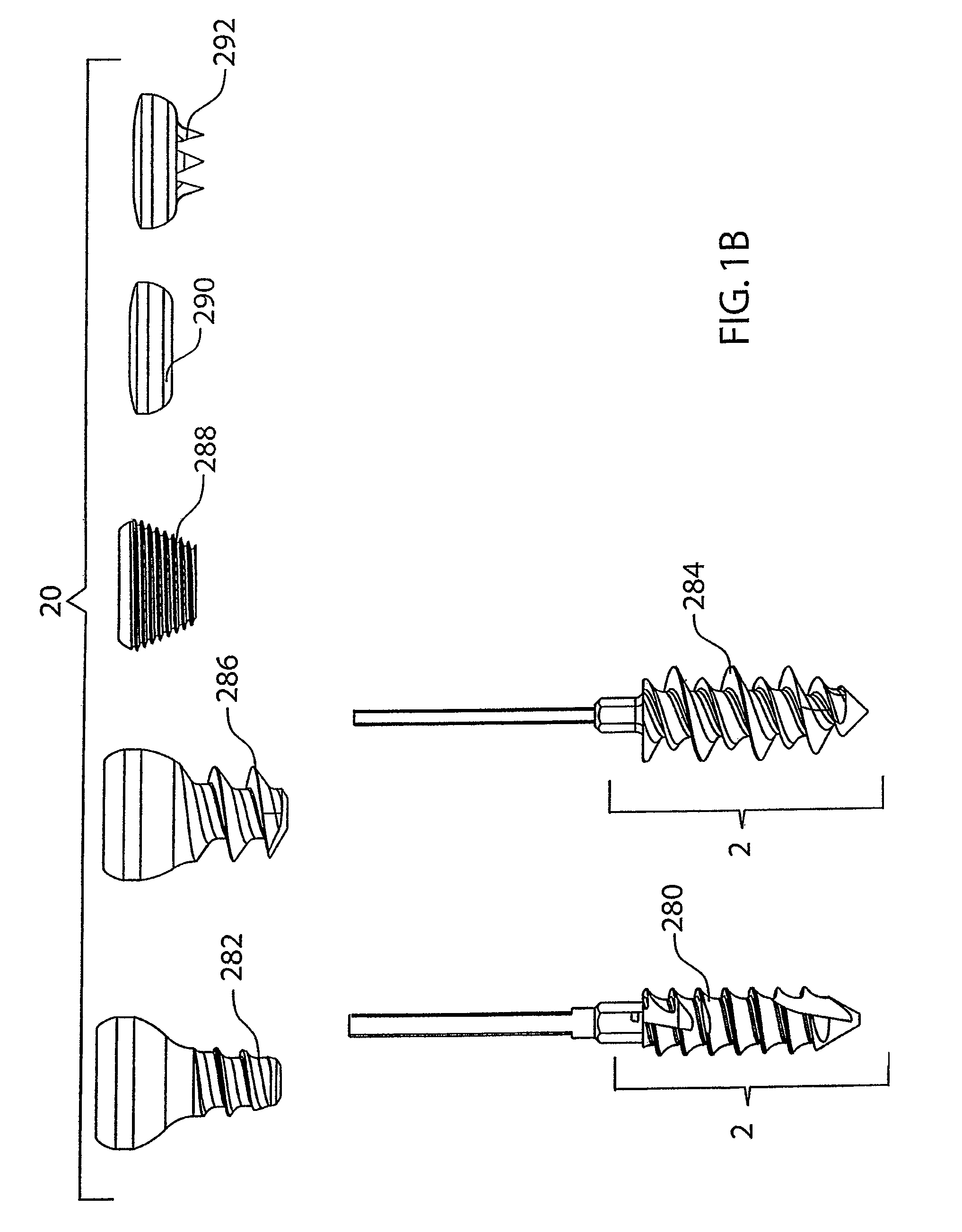 Bone screw system and method