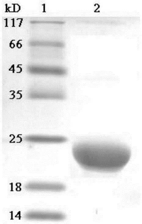 Application of fibroblast growth factor-21 mature peptide in preparation of hepatic fibrosis treatment drugs