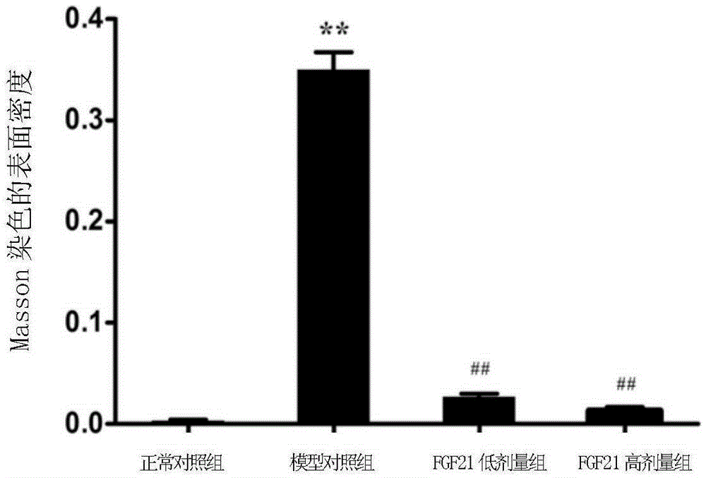 Application of fibroblast growth factor-21 mature peptide in preparation of hepatic fibrosis treatment drugs