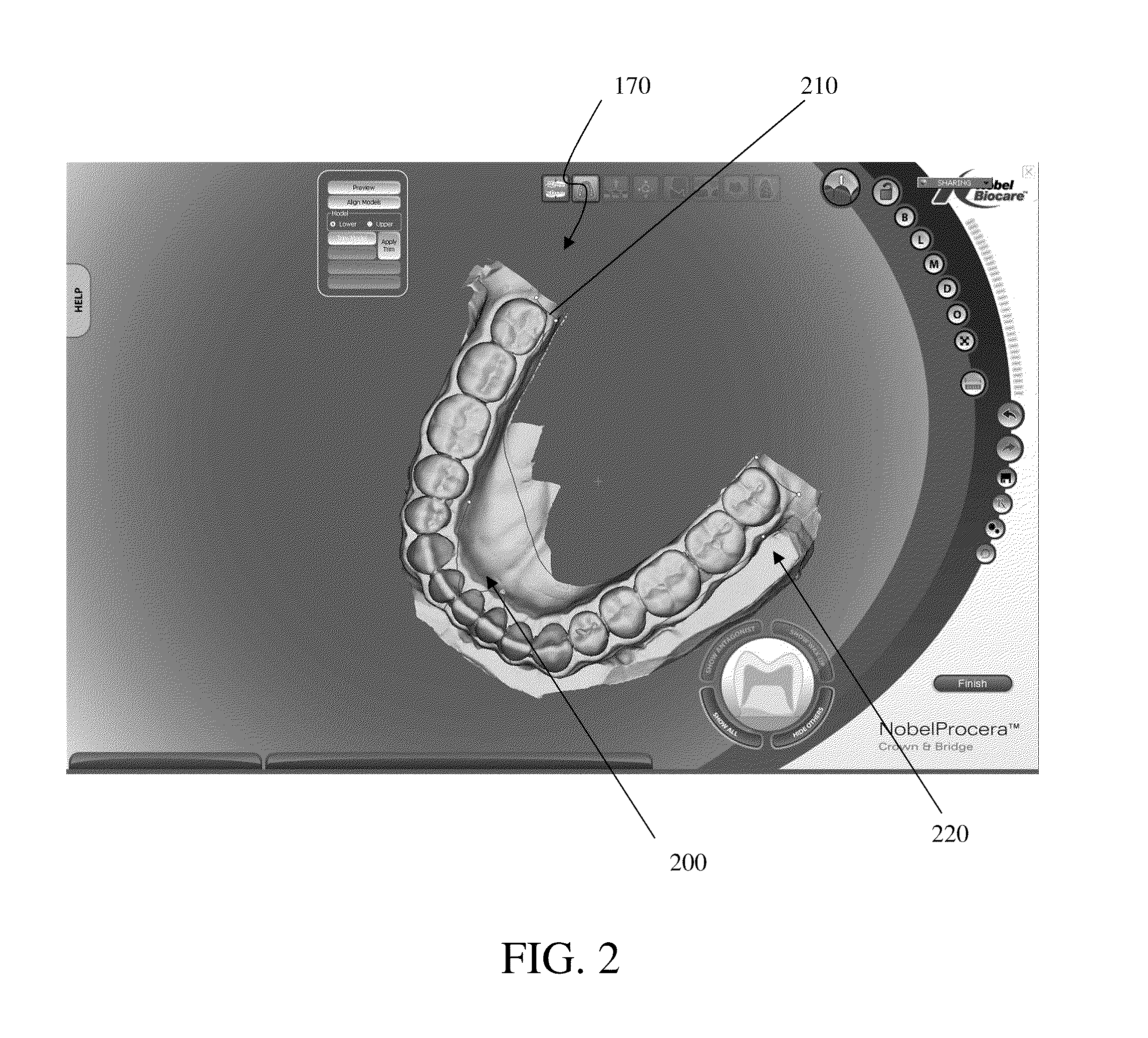 Method for planning a dental component