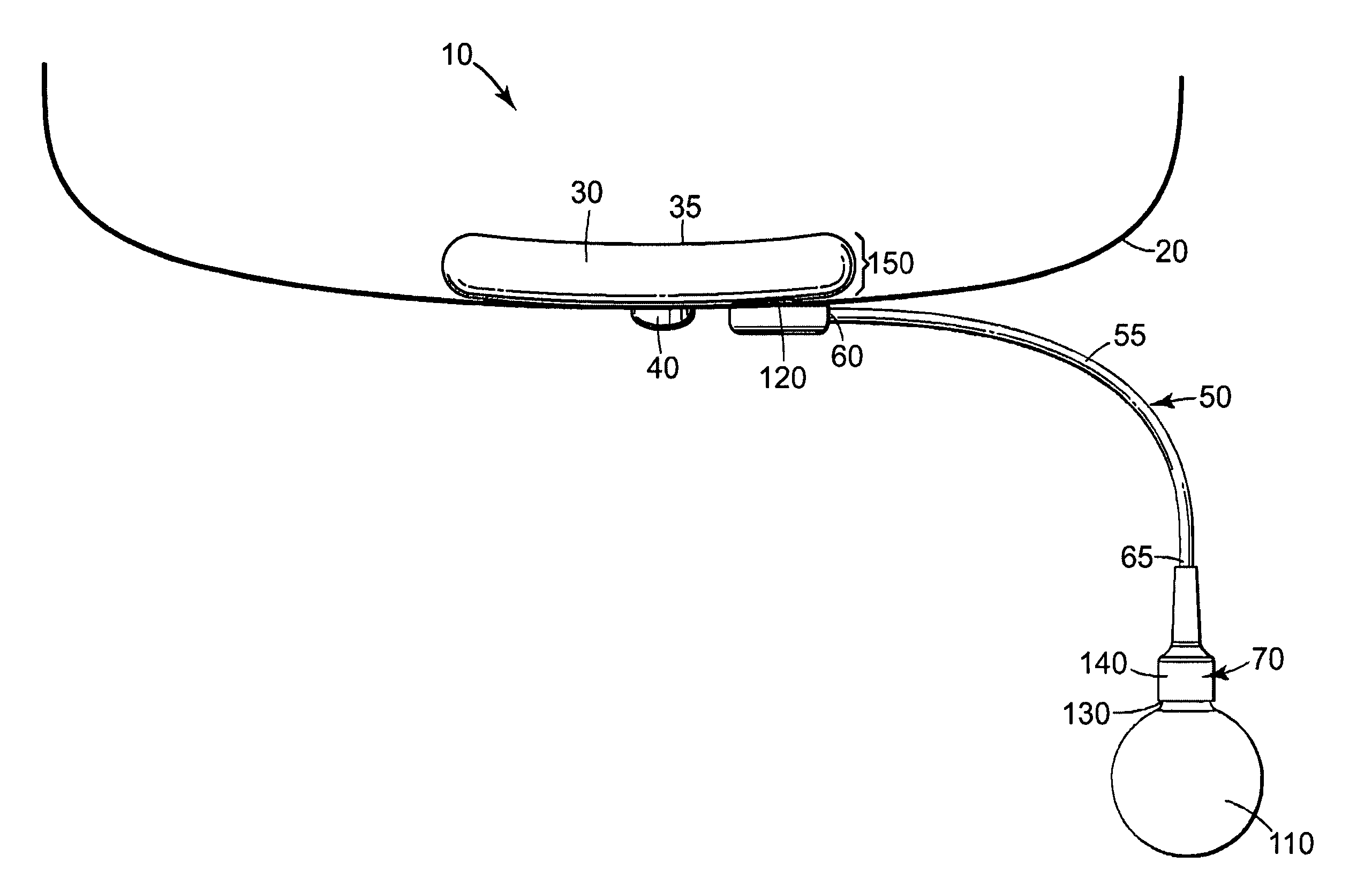 Male urethral prosthesis